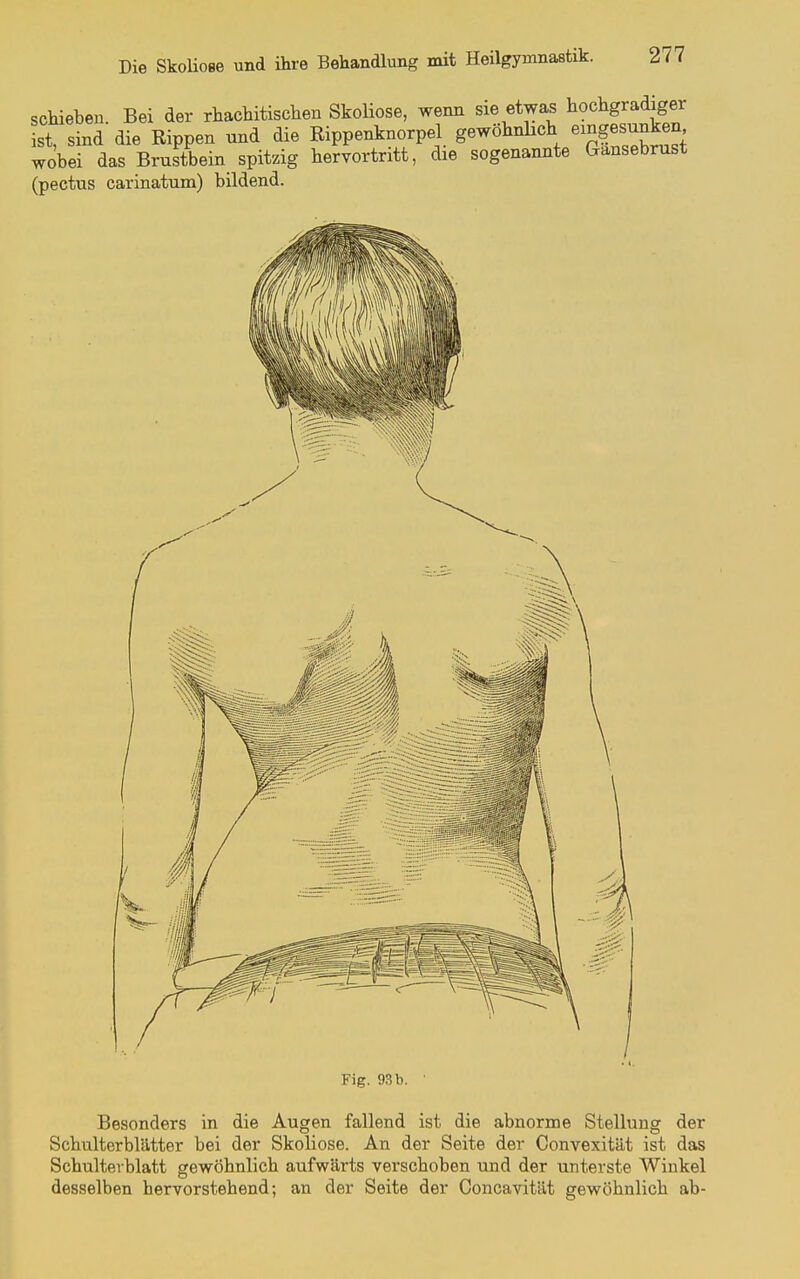 schieben. Bei der rhachitischen Skoliose, wenn sie etwas hochgradiger ist, sind die Rippen und die Rippenknorpel gewöhnlich emgesunken wobei das Brustbein spitzig hervortritt, die sogenannte Gansebrust (pectus carinatum) bildend. Fig. 93 b. ■ Besonders in die Augen fallend ist die abnorme Stellung der Schulterblätter bei der Skoliose. An der Seite der Convexität ist das Schulterblatt gewöhnlich aufwärts verschoben und der unterste Winkel desselben hervorstehend; an der Seite der Concavität gewöhnlich ab-