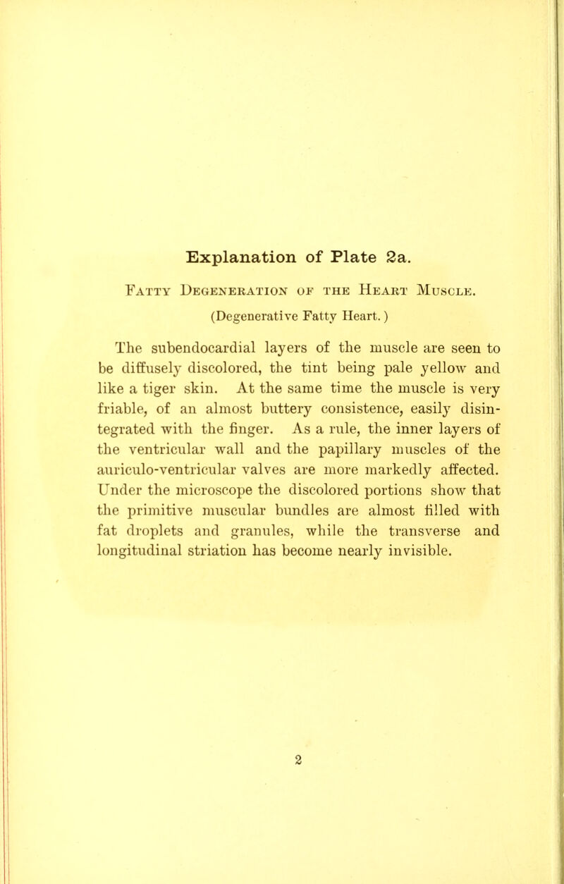 Fatty Degeneration of the Heart Muscle. (Degenerative Fatty Heart.) The subendocardial layers of the muscle are seen to be diffusely discolored, the tint being pale yellow and like a tiger skin. At the same time the muscle is very friable, of an almost buttery consistence, easily disin- tegrated with the finger. As a rule, the inner layers of the ventricular wall and the papillary muscles of the auriculo-ventricular valves are more markedly affected. Under the microscope the discolored portions show that the primitive muscular bundles are almost filled with fat droplets and granules, while the transverse and longitudinal striation has become nearly invisible.