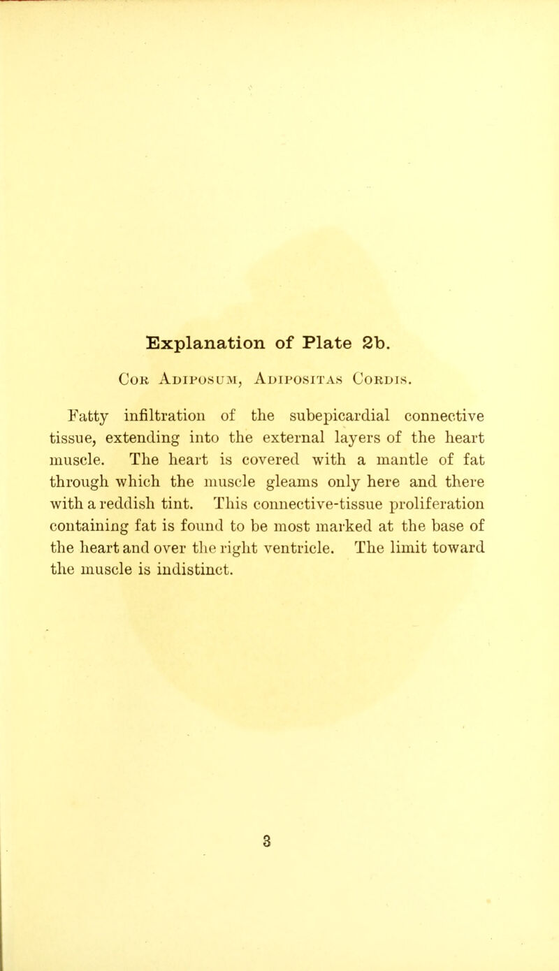 CoK Adifosum, Adipositas Cordis. Fatty infiltration of the subepicardial connective tissue, extending into the external layers of the heart muscle. The heart is covered with a mantle of fat through which the muscle gleams only here and there with a reddish tint. This connective-tissue proliferation containing fat is found to be most marked at the base of the heart and over tlie right ventricle. The limit toward the muscle is indistinct.
