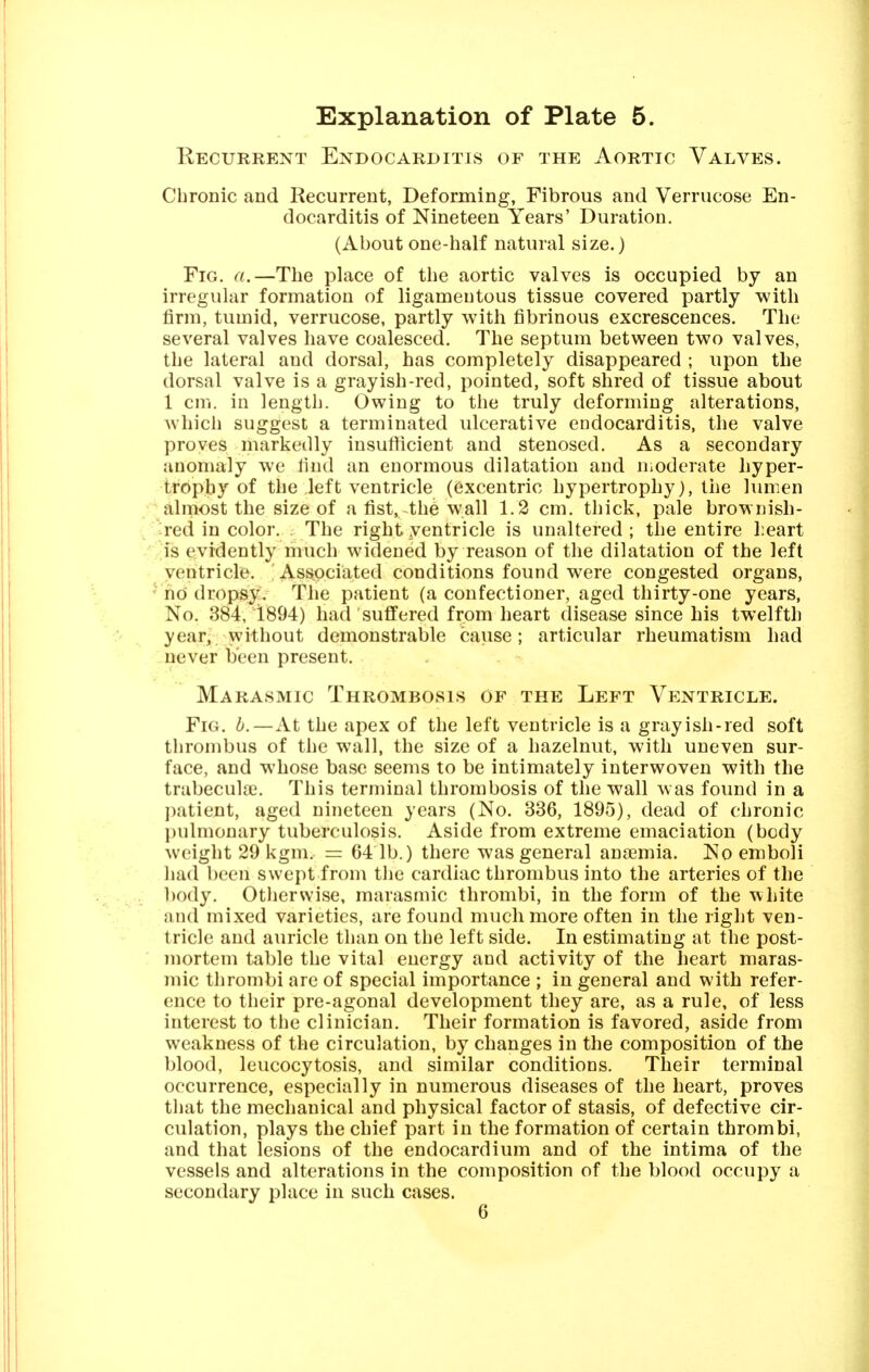 Eecurrent Endocarditis of the Aortic Valves. Chronic and Recurrent, Deforming, Fibrous and Verrucose En- docarditis of Nineteen Years' Duration. (Aboutone-half natural size.) Fig. a.—The place of the aortic valves is occupied by an irregular formation of ligamentous tissue covered partly with firm, tumid, verrucose, partly with fibrinous excrescences. The several valves have coalesced. The septum between two valves, the lateral and dorsal, has completely disappeared ; upon the dorsal valve is a grayish-red, pointed, soft shred of tissue about 1 cm. in length. Owing to the truly deforming alterations, which suggest a terminated ulcerative endocarditis, the valve proves markedly insufficient and stenosed. As a secondary anomaly we find an enormous dilatation and Uiodcrate hyper- trophy of the left ventricle (excentric hypertrophy), the lumen almost the size of afist, the wall 1.2 cm. thick, pale brownish- •red in color. The right ventricle is unaltered ; the entire l.eart is evidently much widened by reason of the dilatation of the left ventricle, i Associated conditions found were congested organs, ' ho dropsj?. The patient (a confectioner, aged thirty-one years, No. 384, 1894) had suffered from heart disease since his twelfth year, without demonstrable cause; articular rheumatism had never been present. Marasmic Thrombosis of the Left Ventricle. Fig. i.—At the apex of the left ventricle is a grayish-red soft thrombus of the wall, the size of a hazelnut, with uneven sur- face, and whose base seems to be intimately interwoven with the trabecule. This terminal thrombosis of the wall was found in a patient, aged nineteen years (No. 336, 1895), dead of chronic pulmonary tuberculosis. Aside from extreme emaciation (body weight 29 kgm. = 64 lb.) there was general ancemia. No emboli had been swept from tlie cardiac thrombus into the arteries of the body. Otlierwise, marasmic thrombi, in the form of the white and mixed varieties, are found much more often in the right ven- tricle and auricle than on the left side. In estimating at the post- mortem table the vital energy and activity of the heart maras- mic thrombi are of special importance ; in general and with refer- ence to their pre-agonal development they are, as a rule, of less interest to the clinician. Their formation is favored, aside from weakness of the circulation, by changes in the composition of the blood, leucocytosis, and similar conditions. Their terminal occurrence, especially in numerous diseases of the heart, proves that the mechanical and physical factor of stasis, of defective cir- culation, plays the chief part in the formation of certain thrombi, and that lesions of the endocardium and of the intima of the vessels and alterations in the composition of the blood occupy a secondary place in such cases.
