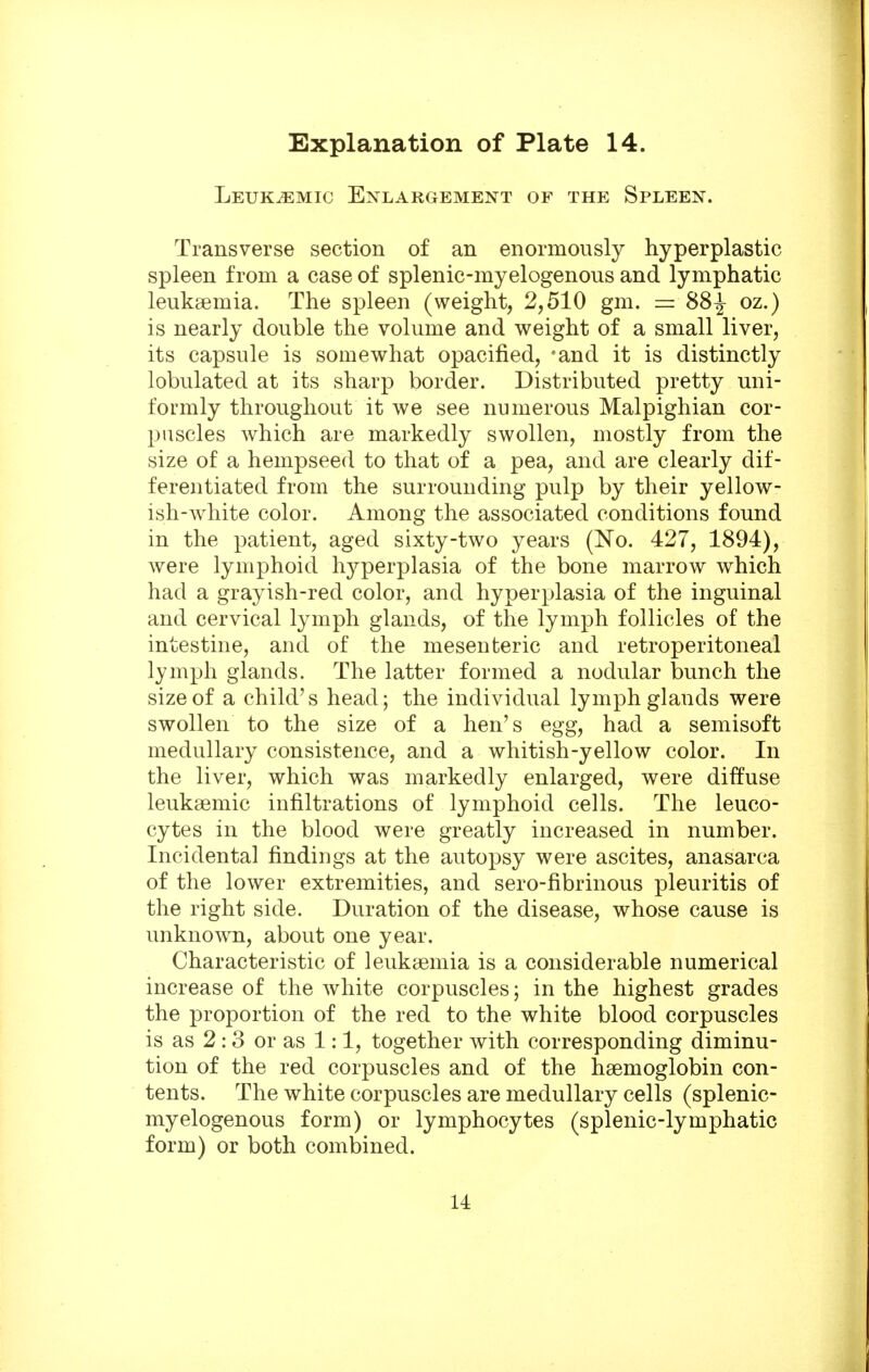Leukemic Enlargement of the Spleen. Transverse section of an enormously hyperplastic spleen from a case of splenic-myelogenous and lymphatic leukaemia. The spleen (weight, 2,510 gm. = 88^ oz.) is nearly double the volume and weight of a small liver, its capsule is somewhat opacified, 'and it is distinctly lobulated at its sharp border. Distributed pretty uni- formly throughout it we see numerous Malpighian cor- puscles which are markedly swollen, mostly from the size of a hempseed to that of a pea, and are clearly dif- ferentiated from the surrounding pulp by their yellow- ish-white color. Among the associated conditions found in the patient, aged sixty-two years (No. 427, 1894), were lymphoid hyperplasia of the bone marrow which had a grayish-red color, and hyperplasia of the inguinal and cervical lymph glands, of the lymph follicles of the intestine, and of the mesenteric and retroperitoneal lymph glands. The latter formed a nodular bunch the size of a child's head; the individual lymph glands were swollen to the size of a hen's egg, had a semisoft medullary consistence, and a whitish-yellow color. In the liver, which was markedly enlarged, were diffuse leuksemic infiltrations of lymphoid cells. The leuco- cytes in the blood were greatly increased in number. Incidental findings at the autopsy were ascites, anasarca of the lower extremities, and sero-fibrinous pleuritis of the right side. Duration of the disease, whose cause is unknown, about one year. Characteristic of leukaemia is a considerable numerical increase of the white corpuscles; in the highest grades the proportion of the red to the white blood corpuscles is as 2 :3 or as 1:1, together with corresponding diminu- tion of the red corpuscles and of the haemoglobin con- tents. The white corpuscles are medullary cells (splenic- myelogenous form) or lymphocytes (splenic-lymphatic form) or both combined. 14