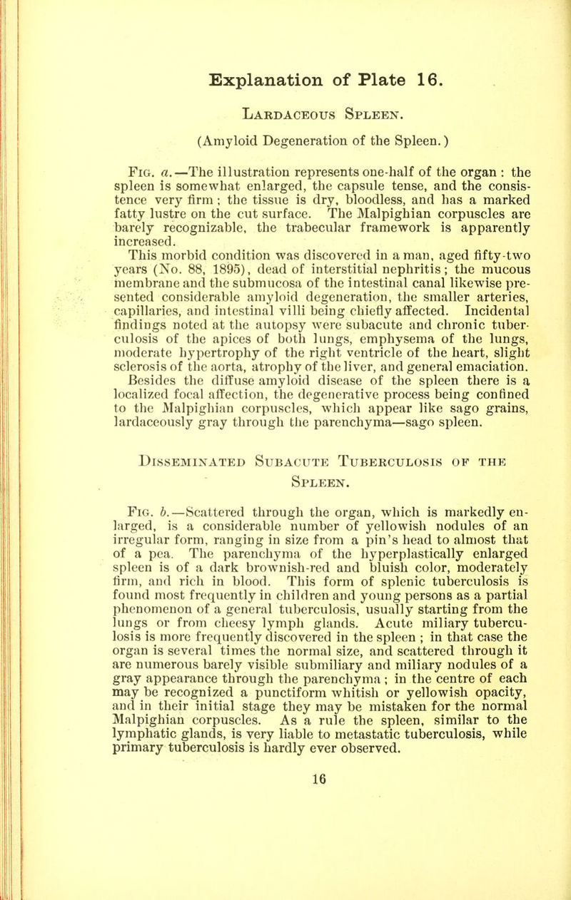 Lardaceous Spleen. (Amyloid Degeneration of the Spleen.) Fig. a.—The illustration represents one-half of the organ : the spleen is somewhat enlarged, the capsule tense, and the consis- tence very firm ; the tissue is dry, bloodless, and has a marked fatty lustre on the cut surface. The Malpighian corpuscles are barely recognizable, the trabecular framework is apparently increased. This morbid condition was discovered in a man, aged fifty-two years (No. 88, 1895), dead of interstitial nephritis; the mucous membrane and the submucosa of the intestinal canal likewise pre- sented considerable amyloid degeneration, the smaller arteries, capillaries, and intestinal villi being chiefly affected. Incidental findings noted at the autopsy were subacute and chronic tuber- culosis of the apices of both lungs, emphysema of the lungs, moderate hypertrophy of the right ventricle of the heart, slight sclerosis of the aorta, atrophy of the liver, and general emaciation. Besides the diffuse amyloid disease of the spleen there is a localized focal affection, the degenerative process being confined to the Malpighian corpuscles, which appear like sago grains, lardaceously gray through the parenchyma—sago spleen. Disseminated Subacute Tuberculosis of the Spleen. Fig, b.—Scattered through the organ, which is markedly en- larged, is a considerable number of yellowish nodules of an irregular form, ranging in size from a pin's head to almost that of a pea. The parenchyma of the hyperplastically enlarged spleen is of a dark brownish-red and bluish color, moderately firm, and rich in blood. This form of splenic tuberculosis is found most frequently in children and young persons as a partial phenomenon of a general tuberculosis, usually starting from the lungs or from cheesy lymph glands. Acute miliary tubercu- losis is more frequently discovered in the spleen ; in that case the organ is several times the normal size, and scattered through it are numerous barely visible submiliary and miliary nodules of a gray appearance through the parenchyma ; in the centre of each may be recognized a punctiform whitish or yellowish opacity, and in their initial stage they may be mistaken for the normal Malpighian corpuscles. As a rule the spleen, similar to the lymphatic glands, is very liable to metastatic tuberculosis, while primary tuberculosis is hardly ever observed. 16