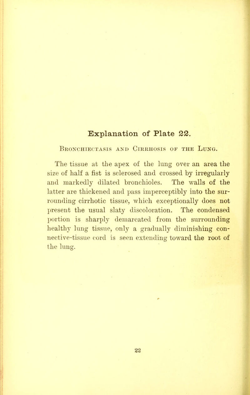 Bronchiectasis and Cirrhosis of the Lung. The tissue at the apex of the lung over an area the size of half a fist is sclerosed and crossed by irregularly and markedly dilated bronchioles. The walls of the latter are thickened and pass imperceptibly into the sur- rounding cirrhotic tissue, which exceptionally does not present the usual slaty discoloration. The condensed portion is sharply demarcated from the surrounding healthy lung tissue, only a gradually diminishing con- nective-tissue cord is seen extending toward the root of the lung. 22