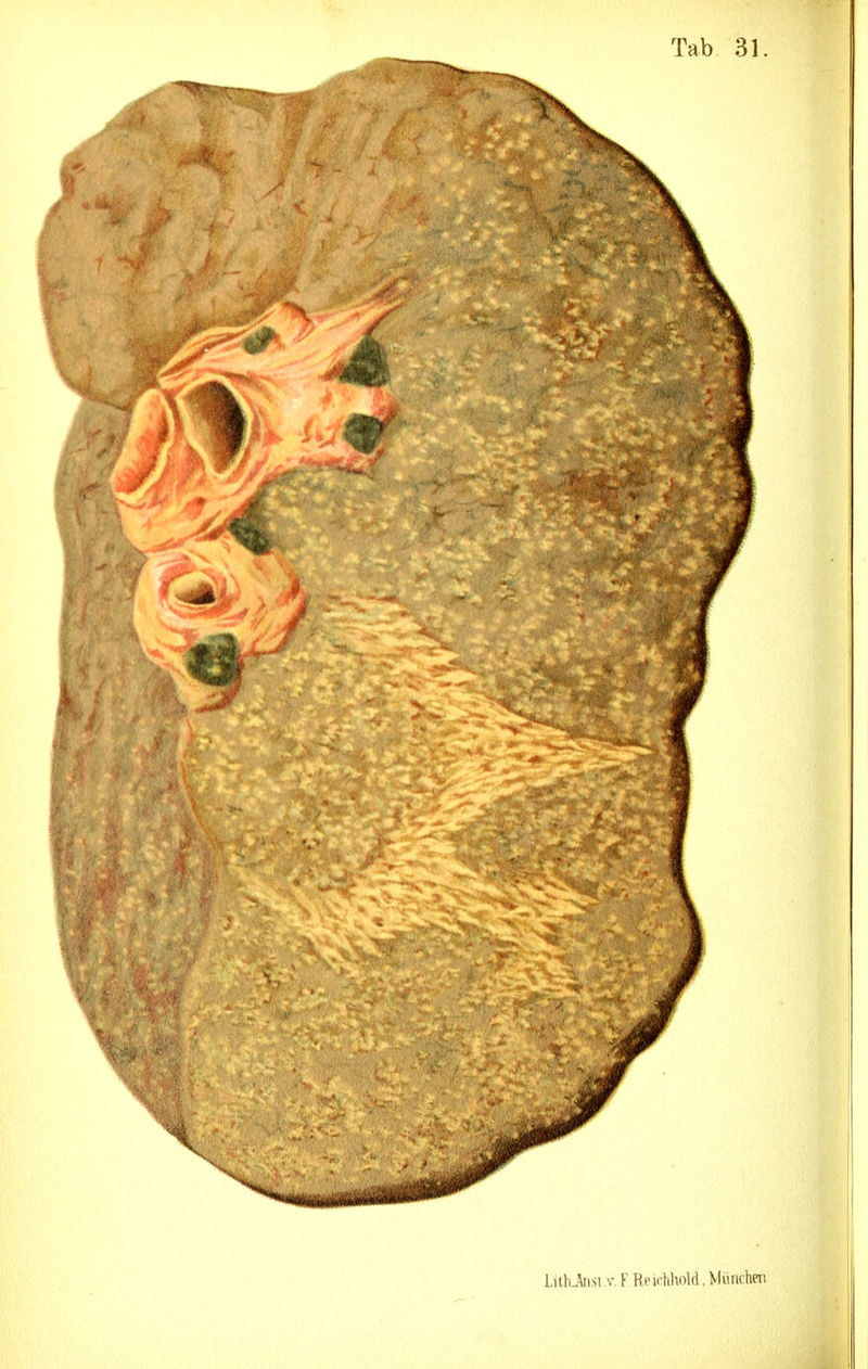 l.iÜi.Aiisi y.K Hni-t.holfl , München
