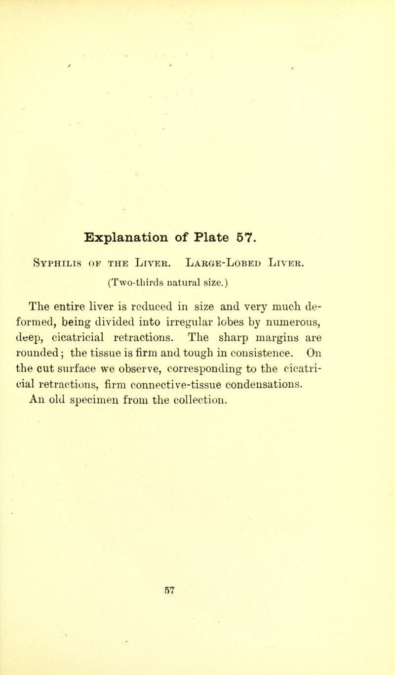 Syphilis of the Liver. Large-Lobed Liver. (Two-tliirds natural size.) The entire liver is reduced in size and very much de- formed, being divided into irregular lobes by numerous, deep, cicatricial retractions. The sharp margins are rounded; the tissue is firm and tough in consistence. On the cut surface we observe, corresponding to the cicatri- cial retractions, firm connective-tissue condensations. An old specimen from the collection. 57