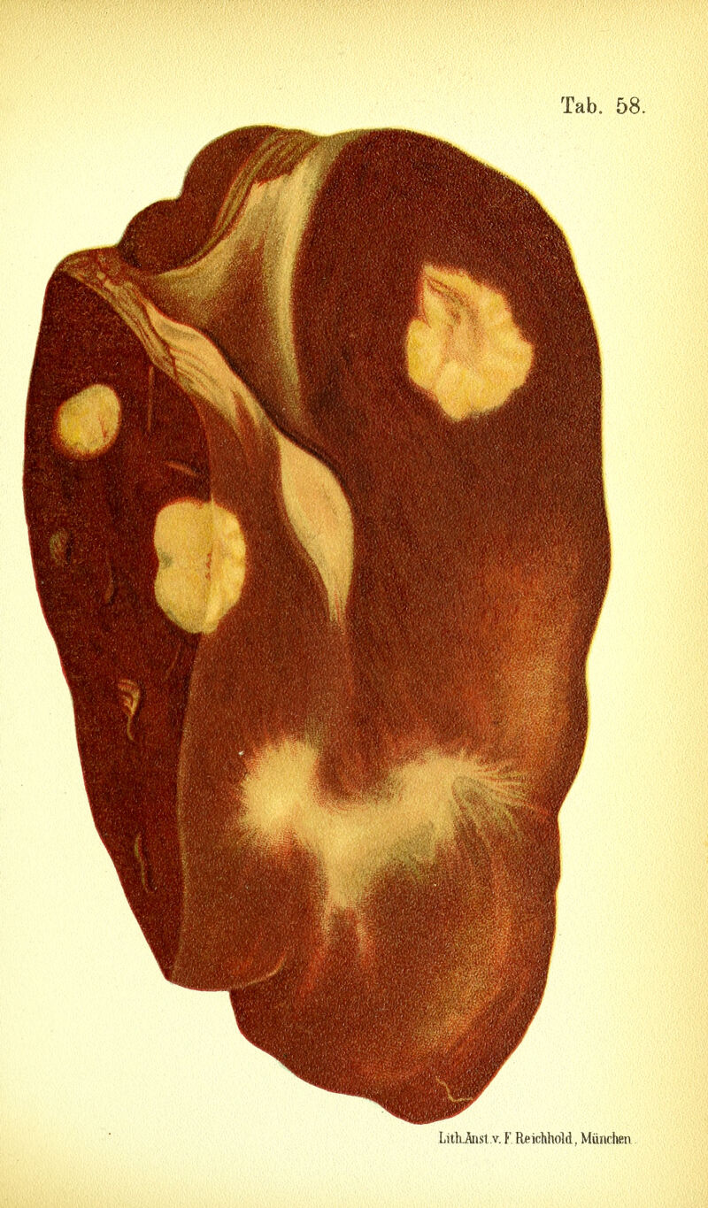 LitLÄnst.v. Y Reichhold, München