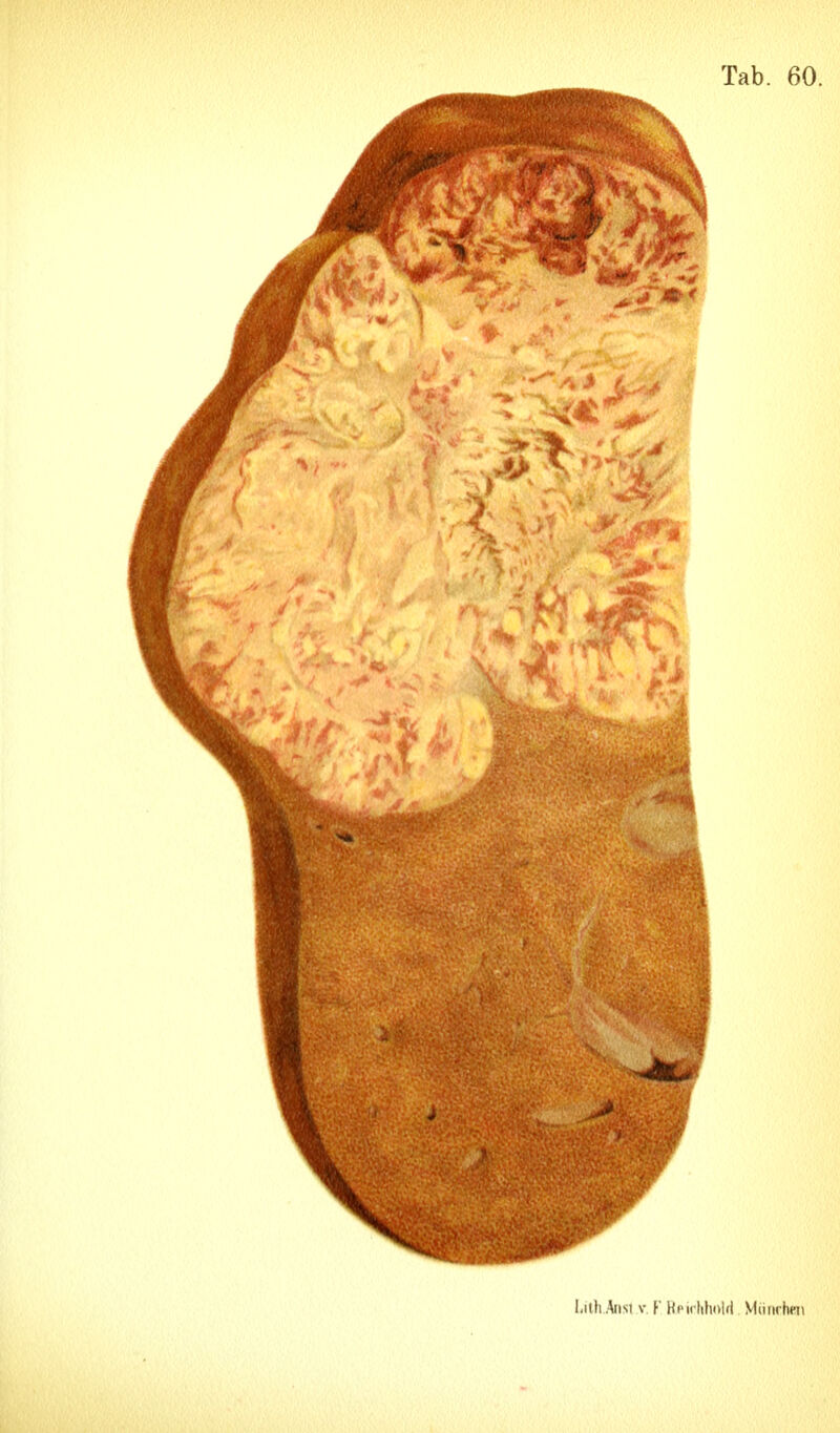 I.ilh Ansl V y Hpirhholfi Vliiru heii