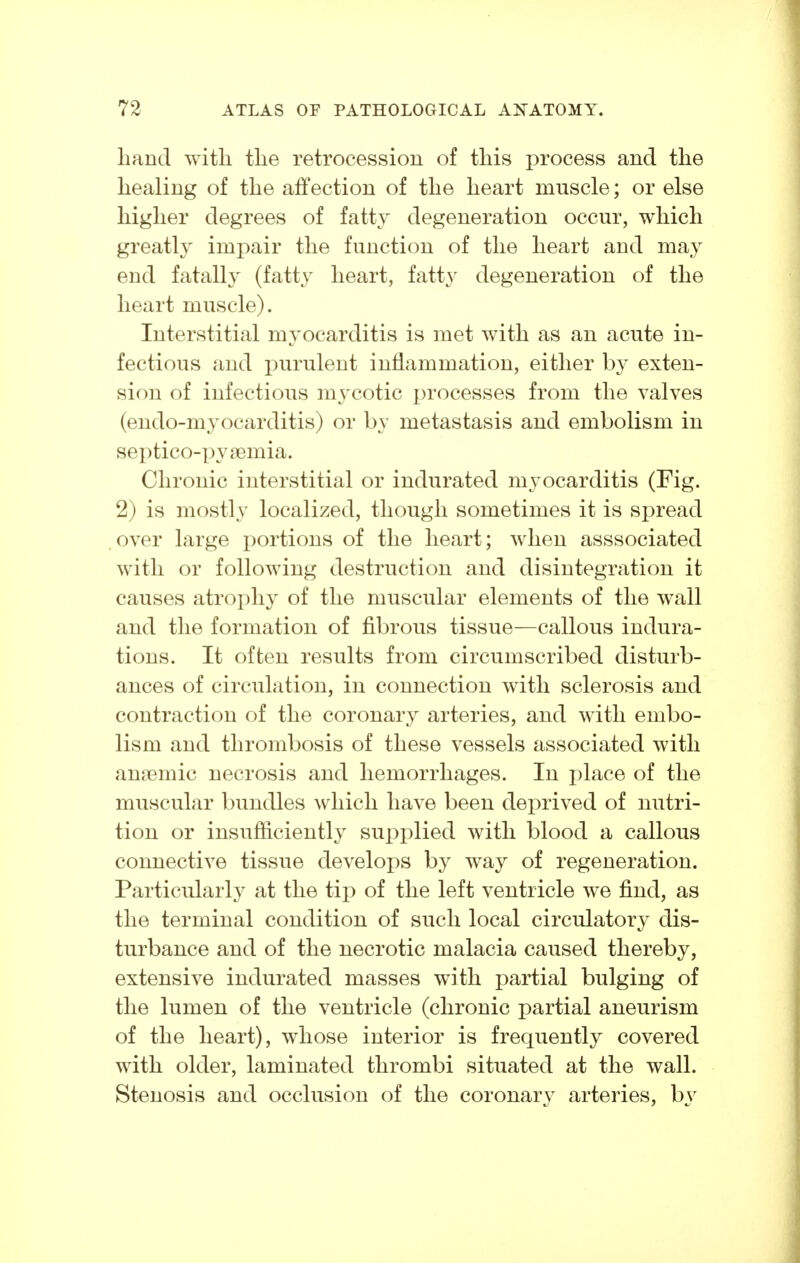 hand with the retrocession of this process and the healing of the affection of the heart muscle; or else higher degrees of fatty degeneration occur, which greatly impair the function of the heart and may end fatally (fatty heart, fatty degeneration of the heart muscle). Interstitial myocarditis is met with as an acute in- fectious and purulent inflammation, either by exten- sion of infectious mj^cotic processes from the valves (endo-myocarditis) or by metastasis and embolism in septico-pyaemia. Chronic interstitial or indurated myocarditis (Fig. 2) is mostly localized, though sometimes it is spread over large portions of the heart; when asssociated with or following destruction and disintegration it causes atrophy of the muscular elements of the wall and the formation of fibrous tissue—callous indura- tions. It often results from circumscribed disturb- ances of circulation, in connection with sclerosis and contraction of the coronary arteries, and with embo- lism and thrombosis of these vessels associated with anaemic necrosis and hemorrhages. In place of the muscular bundles which have been deprived of nutri- tion or insufficiently supplied with blood a callous connective tissue develops by way of regeneration. Particularly at the tip of the left ventricle we find, as the terminal condition of such local circulatory dis- turbance and of the necrotic malacia caused thereby, extensive indurated masses with partial bulging of the lumen of the ventricle (chronic partial aneurism of the heart), whose interior is frequently covered with older, laminated thrombi situated at the wall. Stenosis and occlusion of the coronary arteries, by
