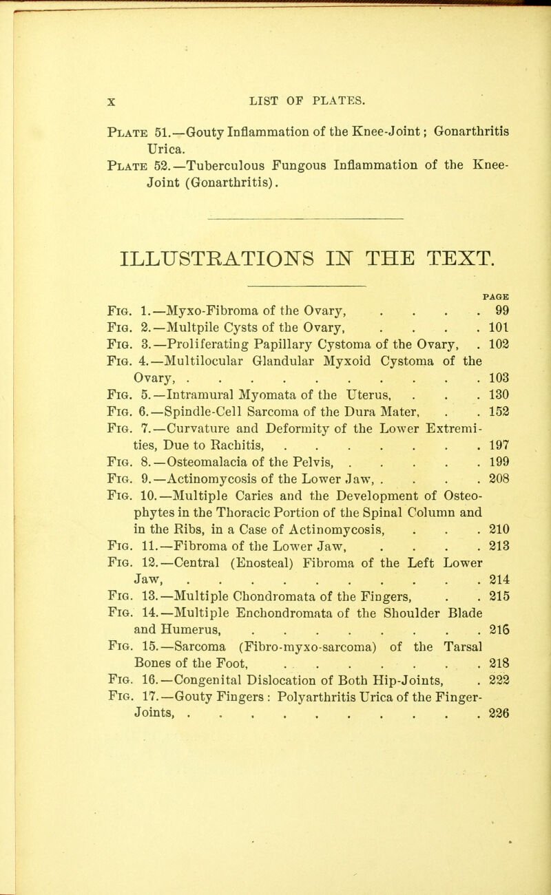 Plate 51.—Gouty Inflammation of the Knee-Joint; Gonarthritis Urica. Plate 52.—Tuberculous Fungous Inflammation of the Knee- Joint (Gonarthritis). ILLXJSTEATIOIsrS IN THE TEXT. Fig. 1.—Myxo-Fibroma of the Ovary, . . . .99 Fig. 2.—Multpile Cysts of the Ovary, . . . .101 Fig. 3.—Proliferating Papillary Cystoma of the Ovary, . 102 Fig. 4.—Multilocular Glandular Myxoid Cystoma of the Fig. 5.—Intramural Myomata of the Uterus, . . . 130 Fig. 6.—Spindle-Cell Sarcoma of the Dura Mater, . . 152 Fig. 7.—Curvature and Deformity of the Lower Extremi- FiG. 9.—Actinomycosis of the Lower Jaw, . . . . 208 Fig. 10.—Multiple Caries and the Development of Osteo- phytes in the Thoracic Portion of the Spinal Column and in the Ribs, in a Case of Actinomycosis, . . . 210 Fig, 11.—Fibroma of the Lower Jaw, .... 213 Fig. 12.—Central (Enosteal) Fibroma of the Left Lower Jaw 214 Fig. 13.—Multiple Chondromata of the Fingers, . . 215 Fig. 14.—Multiple Enchondromata of the Shoulder Blade and Humerus, 216 Fig. 15.—Sarcoma (Fibro-myxo-sarcoma) of the Tarsal Bones of the Foot, 218 Fig. 16.—Congenital Dislocation of Both Hip-Joints, . 222 Fig. 17.—Gouty Fingers : Polyarthritis Urica of the Finger- Joints, 226 PAGE Ovary, . 103 ties. Due to Rachitis, Fig. 8.—Osteomalacia of the Pelvis, 197 199