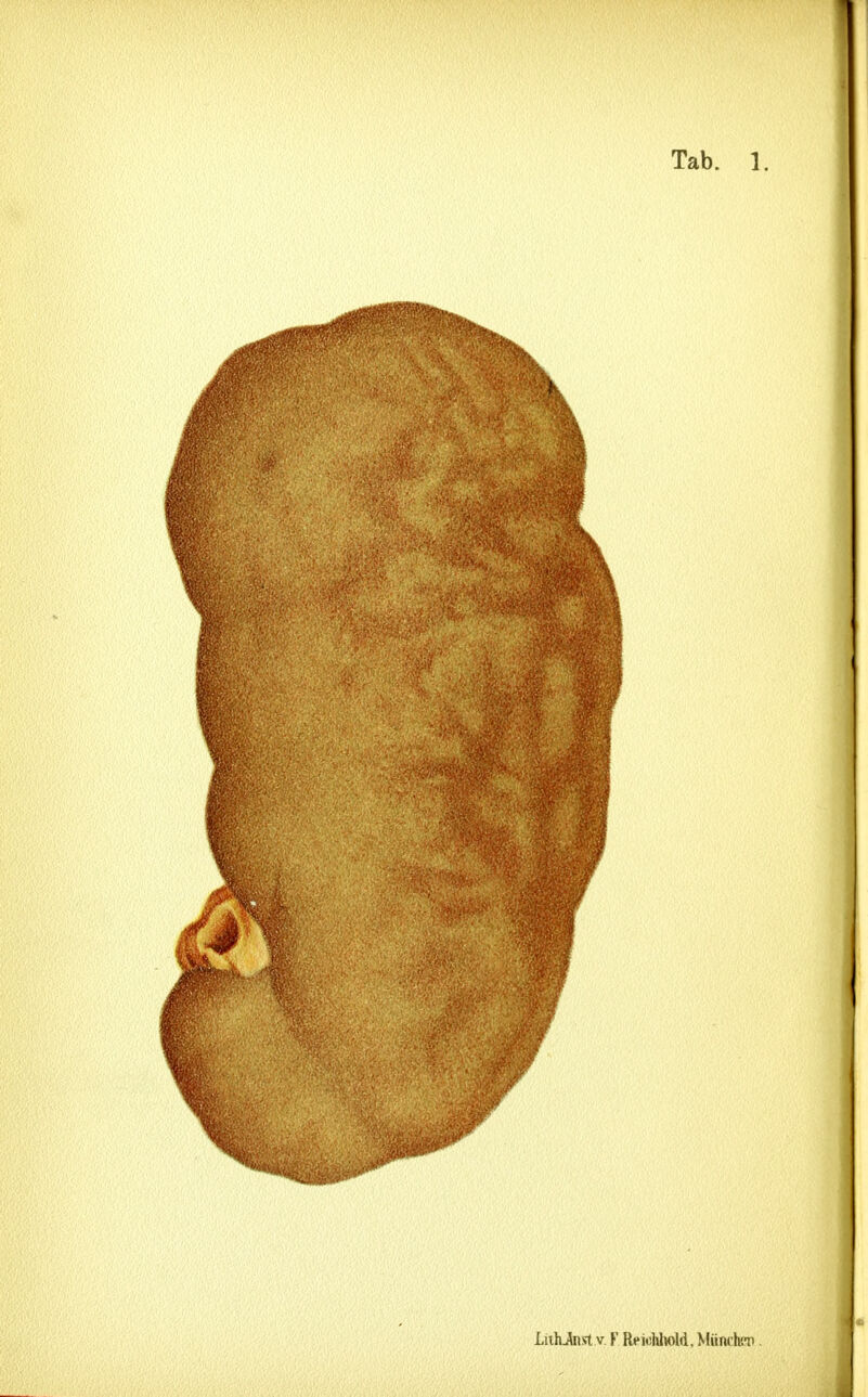 LiihJnst V F Reiclüwld, MiinclCT