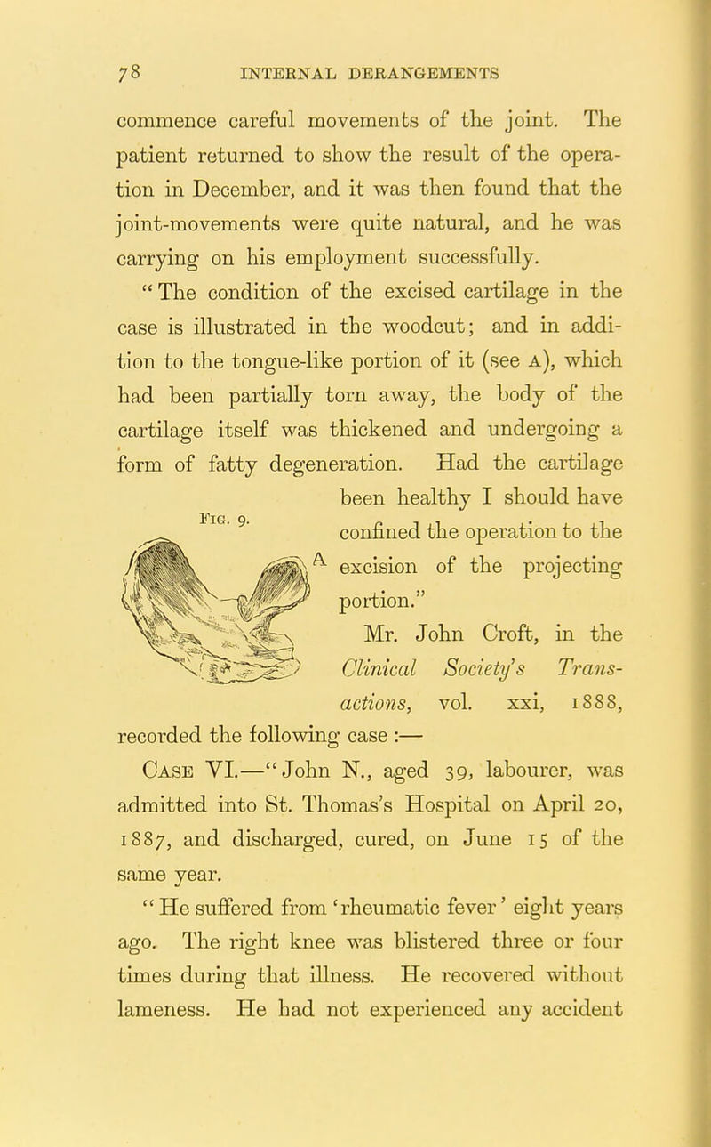 commence careful movements of the joint. The patient returned to show the result of the opera- tion in December, and it was then found that the joint-movements were quite natural, and he was carrying on his employment successfully.  The condition of the excised cartilage in the case is illustrated in the woodcut; and in addi- tion to the tongue-like portion of it (see a), which had been partially torn away, the body of the cartilage itself was thickened and undergoing a form of fatty degeneration. Had the cartilage been healthy I should have ^' confined the operation to the /^^^'^ excision of the projecting ^^^^Js^ Mr. John Croft, in the '^•li^S^s^^ Clinical Society's Trans- actions, vol. xxi, 1888, recorded the following case :— Case YI.—John N., aged 39, labourer, was admitted into St. Thomas's Hospital on April 20, 1887, and discharged, cured, on June 15 of the same year.  He suffered from 'rheumatic fever' eiglit years ago. The right knee was blistered three or four times during that illness. He recovered without lameness. He had not experienced any accident