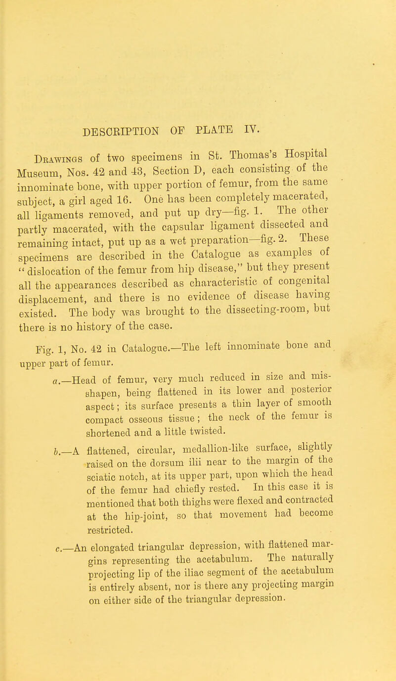 Drawings of two specimens in St. Thomas's Hospital Museum, Nos. 42 and 43, Section D, each consisting of the innominate bone, with upper portion of femur, from the same subject, a girl aged 16. One has been completely macerated, all ligaments removed, and put up dry—fig. 1. The other partly macerated, with the capsular ligament dissected and remaining intact, put up as a wet preparation—fig. 2. These specimens are described in the Catalogue as examples of  dislocation of the femur from hip disease, but they present all the appearances described as characteristic of congenital displacement, and there is no evidence of disease having existed. The body was brought to the dissecting-room, but there is no history of the case. Fig. 1, No. 42 in Catalogue.—The left innominate bone and upper part of femur. a. —Head of femur, very much reduced in size and mis- shapen, being flattened in its lower and posterior aspect; its surface presents a thin layer of smooth compact osseous tissue; the neck of the femur is shortened and a little twisted. b. —k flattened, circular, medallion-hke surface, shghtly raised on the dorsum ilii near to the margin of the sciatic notch, at its upper part, upon which the head of the femur had chiefly rested. In this case it is mentioned that both thighs were flexed and contracted at the hip-joint, so that movement had become restricted. c—An elongated triangular depression, with flattened mar- gins representing the acetabulum. The naturally projecting Up of the iUac segment of the acetabulum is entirely absent, nor is there any projecting margin on either side of the triangular depression.