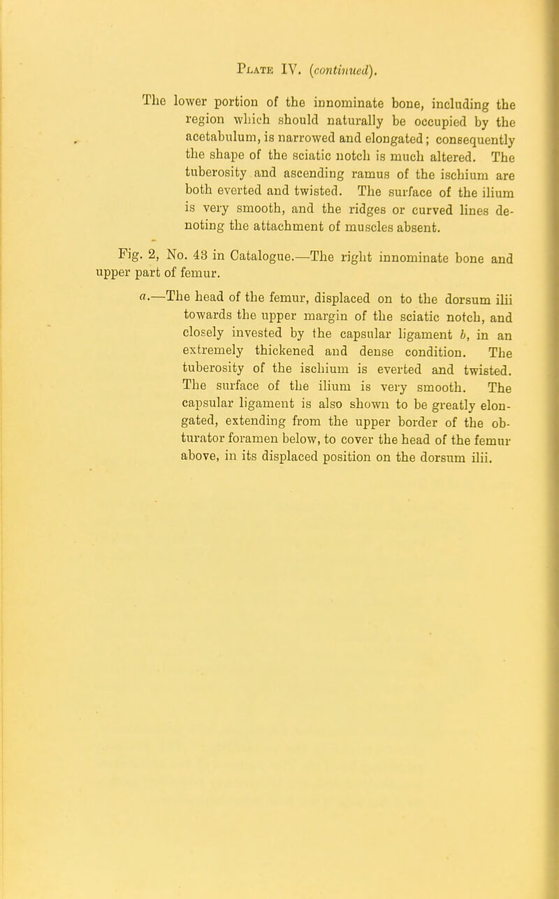 Plate IV. (continued). The lower portion of the innominate bone, induding the region which should naturally be occupied by the acetabulum, is narrowed and elongated; consequently the shape of the sciatic notch is much altered. The tuberosity and ascending ramus of the ischium are both everted and twisted. The surface of the ilium is very smooth, and the ridges or curved lines de- noting the attachment of muscles absent. Fig. 2, No. 43 in Catalogue.—The right innominate bone and upper part of femur. a.—The head of the femur, displaced on to the dorsum ilii towards the upper margin of the sciatic notch, and closely invested by the capsular ligament b, in an extremely thickened and dense condition. The tuberosity of the ischium is everted and twisted. The surface of the ilium is very smooth. The capsular ligament is also shown to be greatly elon- gated, extending from the upper border of the ob- turator foramen below, to cover the head of the femur above, in its displaced position on the dorsum ilii.