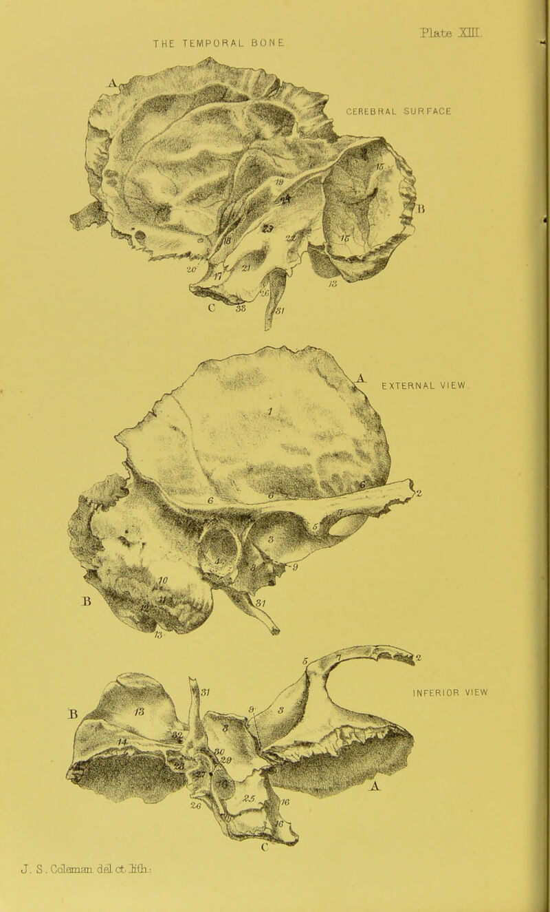 THE TEMPORAL BONE
