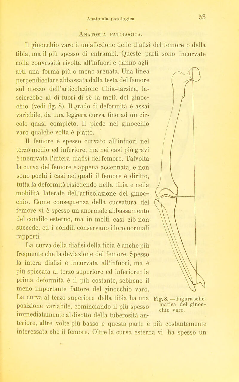 Anatomia patologica. 11 ginocchio varo è un'affezione delle cliafisi del femore o della tibia, ma il più spesso di entrambi. Queste parti sono incurvate colla convessità rivolta all'infuori e danno agli arti una forma più o meno arcuata. Una linea perpendicolare abbassata dalla testa del femore sul mezzo dell'articolazione tibia-tarsica, la- scierebbe al di fuori di sè la metà del ginoc- chio (vedi fig. 8). Il grado di deformità è assai variabile, da una leggera curva fino ad un cir- colo quasi completo. Il piede nel ginocchio varo qualche volta è piatto. Il femore è spesso curvato all'infuori nel terzo medio ed inferiore, ma nei casi più gravi è incurvata l'intera diafisi del femore. Talvolta la curva del femore è appena accennata, e non sono pochi i casi nei quali il femore è diritto, tutta la deformità risiedendo nella tibia e nella mobilità laterale dell'articolazione del ginoc- chio. Come conseguenza della curvatura del femore vi è spesso un anormale abbassamento del condilo esterno, ma in molti casi ciò non succede, ed i condili conservano i loro normali rapporti. La curva della diafisi della tibia è anche più frequente che la deviazione del femore. Spesso la intera diafisi è incurvata all'infuori, ma è più spiccata al terzo superiore ed inferiore: la prima deformità è il più costante, sebbene il meno importante fattore del ginocchio varo. La curva al terzo superiore della tibia ha una posizione variabile, cominciando il più spesso immediatamente al disotto della tuberosità an- teriore, altre volte più basso e questa parte è più costantemente interessata che il femore. Oltre la curva esterna vi ha spesso un Fig. 8. — Figura sche- matica del ginoc- chio varo.