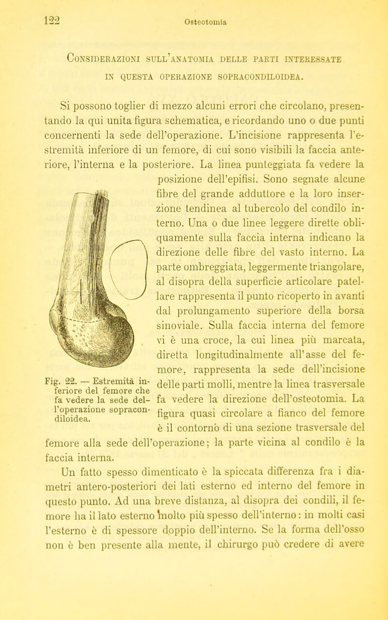 Considerazioni sull'anatomia delle parti interessate in questa operazione sopracondlloidea. Si possono toglier di mezzo alcuni errori che circolano, presen- tando la qui unita figura schematica, e ricordando uno o due punti concernenti la sede dell'operazione. L'incisione rappresenta l'e- stremità inferiore di un femore, di cui sono visibili la faccia ante- riore, l'interna e la posteriore. La linea punteggiata fa vedere la posizione dell'epifisi. Sono segnate alcune fibre del grande adduttore e la loro inser- zione tendinea al tubercolo del condilo in- terno. Una o due linee leggere dirette obli- quamente sulla faccia interna indicano la direzione delle fibre del vasto interno. La parte ombreggiata, leggermente triangolare, al disopra della superficie articolare patel- lare rappresenta il punto ricoperto in avanti dal prolungamento superiore della borsa sino viale. Sulla faccia interna del femore vi è una croce, la cui linea più marcata, diretta longitudinalmente all'asse del fe- more, rappresenta la sede dell'incisione Fig. 22. — Estremità in- ^elle parti mo\\[ mentre la linea trasversale tenore del femore che 1 / . fa vedere la sede del- fa vedere la direzione dell'osteotomia. La diloideaÌOne sopracon' figura quasi circolare a fianco del femore è il contornò di una sezione trasversale del femore alla sede dell'operazione; la parte vicina al condilo è la faccia interna. Un fatto spesso dimenticato è la spiccata differenza fra i dia- metri antero-posteriori dei lati esterno ed interno del femore in questo punto. Ad una breve distanza, al disopra dei condili, il fe- more ha il lato esterno Vnolto più spesso dell'interno: in molti casi l'esterno è di spessore doppio dell'interno. Se la forma dell'osso non è ben presente alla mente, il chirurgo può credere di avere