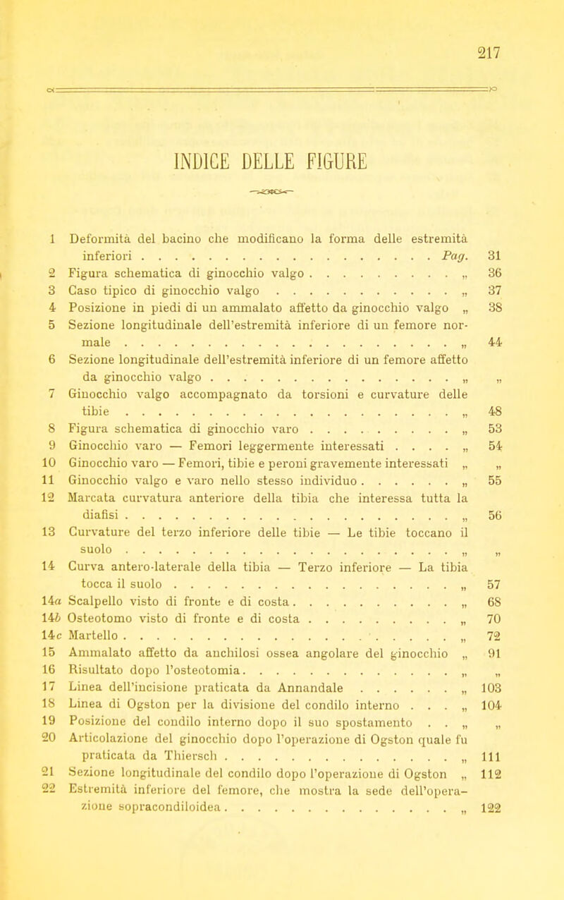 INDICE DELLE FIGURE 1 Deformità del bacino che modificano la forma delle estremità inferiori Pag- 31 2 Figura schematica di ginocchio valgo „ 36 3 Caso tipico di ginocchio valgo „ 37 4 Posizione in piedi di un ammalato affetto da ginocchio valgo „ 38 5 Sezione longitudinale dell'estremità inferiore di un femore nor- male ; „ 44 6 Sezione longitudinale dell'estremità inferiore di un femore affetto da ginocchio valgo „ „ 7 Ginocchio valgo accompagnato da torsioni e curvature delle tibie „ 48 8 Figura schematica di ginocchio varo „ 53 9 Ginocchio varo — Femori leggermente interessati . . . . „ 54 10 Ginocchio varo — Femori, tibie e peroni gravemente interessati „ „ 11 Ginocchio valgo e varo nello stesso individuo „ 55 12 Marcata curvatura anteriore della tibia che interessa tutta la dialisi 56 13 Curvature del terzo inferiore delle tibie — Le tibie toccano il suolo 14 Curva antero-laterale della tibia — Terzo inferiore — La tibia tocca il suolo „ 57 14« Scalpello visto di fronte e di costa „ 68 146 Osteotomo visto di fronte e di costa „ 70 14 c Martello • , 72 15 Ammalato affetto da anchilosi ossea angolare del ginocchio „ 91 16 Risultato dopo l'osteotomia „ „ 17 Linea dell'incisione praticata da Annandale „ 103 18 Linea di Ogston per la divisione del condilo interno . . . „ 104 19 Posizione del condilo interno dopo il suo spostamento . . „ „ 20 Articolazione del ginocchio dopo l'operazione di Ogston quale fu praticata da Thiersch ,,111 21 Sezione longitudinale del condilo dopo l'operazione di Ogston „ 112 22 Estremità inferiore del femore, che mostra la sede dell'opera- zione sopracondiloidea „ 122