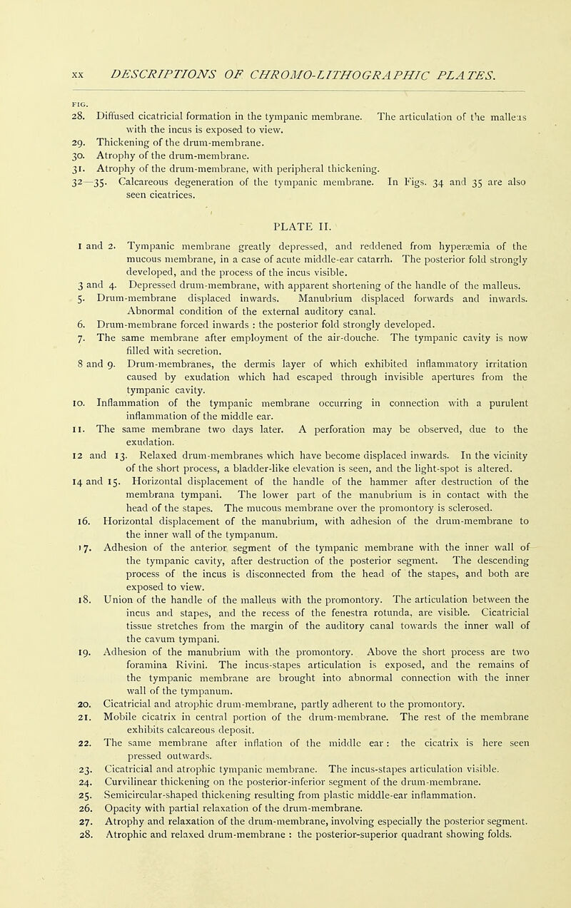 FIG. 28. Diffused cicatricial formation in the tympanic membrane. The articulation of the malleus with the incus is exposed to view. 29. Thickening of the drum-membrane. 30. Atrophy of the drum-membrane. 31. Atrophy of the drum-membrane, with peripheral thickening. 32—35. Calcareous degeneration of the tympanic membrane. In Figs. 34 and 35 are also seen cicatrices. PLATE II. 1 and 2. Tympanic membrane greatly depressed, and reddened from hyperemia of the mucous membrane, in a case of acute middle-ear catarrh. The posterior fold strongly developed, and the process of the incus visible. 3 and 4. Depressed drum-membrane, with apparent shortening of the handle of the malleus. 5. Drum-membrane displaced inwards. Manubrium displaced forwards and inwards. Abnormal condition of the external auditory canal. 6. Drum-membrane forced inwards : the posterior fold strongly developed. 7. The same membrane after employment of the air-douche. The tympanic cavity is now filled with secretion. 8 and 9. Drum-membranes, the dermis layer of which exhibited inflammatory irritation caused by exudation which had escaped through invisible apertures from the tympanic cavity. 10. Inflammation of the tympanic membrane occurring in connection with a purulent inflammation of the middle ear. 11. The same membrane two clays later. A perforation may be observed, due to the exudation. 12 and 13. Relaxed drum-membranes which have become displaced inwards. In the vicinity of the short process, a bladder-like elevation is seen, and the light-spot is altered. 14 and 15. Horizontal displacement of the handle of the hammer after destruction of the membrana tympani. The lower part of the manubrium is in contact with the head of the stapes. The mucous membrane over the promontory is sclerosed. 16. Horizontal displacement of the manubrium, with adhesion of the drum-membrane to the inner wall of the tympanum. 17. Adhesion of the anterior segment of the tympanic membrane with the inner wall of the tympanic cavity, after destruction of the posterior segment. The descending process of the incus is disconnected from the head of the stapes, and both are exposed to view. 18. Union of the handle of the malleus with the promontory. The articulation between the incus and stapes, and the recess of the fenestra rotunda, are visible. Cicatricial tissue stretches from the margin of the auditory canal towards the inner wall of the cavum tympani. 19. Adhesion of the manubrium with the promontory. Above the short process are two foramina Rivini. The incus-stapes articulation is exposed, and the remains of the tympanic membrane are brought into abnormal connection with the inner wall of the tympanum. 20. Cicatricial and atrophic drum-membrane, partly adherent to the promontory. 21. Mobile cicatrix in central portion of the drum-membrane. The rest of the membrane exhibits calcareous deposit. 22. The same membrane after inflation of the middle ear: the cicatrix is here seen pressed outwards. 23. Cicatricial and atrophic tympanic membrane. The incus-stapes articulation visible. 24. Curvilinear thickening on the posterior-inferior segment of the drum-membrane. 25. Semicircular-shaped thickening resulting from plastic middle-ear inflammation. 26. Opacity with partial relaxation of the drum-membrane. 27. Atrophy and relaxation of the drum-membrane, involving especially the posterior segment. 28. Atrophic and relaxed drum-membrane : the posterior-superior quadrant showing folds.