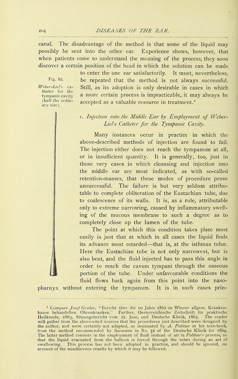 canal. The disadvantage of the method is that some of the liquid may possibly be sent into the other ear. Experience shows, however, that when patients come to understand the meaning of the process, they soon discover a certain position of the head in which the solution can. be made to enter the one ear satisfactorily. It must, nevertheless, Fig. 82. t>e repeated that the method is not always successful. Weber-Lid's ca- Still, as its adoption is only desirable in cases in which theter for the . tympanic cavity a more certain process is impracticable, it may always be (half the ordm- accepted as a valuable resource in treatment.1 ary size). r c. Injection into the Middle Ear by Employment of Weber- Liel's Catheter for the Tympanic Cavity. Many instances occur in practice in which the above-described methods of injection are found to fail. The injection either does not reach the tympanum at all, or in insufficient quantity. It is generally, too, just in those very cases in which cleansing and injection into the middle ear are most indicated, as with so-called retention-masses, that these modes of procedure prove unsuccessful. The failure is but very seldom attribu- table to complete obliteration of the Eustachian tube, due to coalescence of its walls. It is, as a rule, attributable only to extreme narrowing, caused by inflammatory swell- ing of the mucous membrane to such a degree as to completely close up the lumen of the tube. The point at which this condition takes place most easily is just that at which in all cases the liquid finds its advance most retarded—that is, at the isthmus tubae. Here the Eustachian tube is not only narrowest, but is also bent, and the fluid injected has to pass this angle in order to reach the cavum tympani through the osseous portion of the tube. Under unfavourable conditions the fluid flows back again from this point into the naso- pharnyx without entering the tympanum. It is in such cases prin- 1 Compare Josef Gruber, Bericht über die im Jahre 1862 im Wiener allgem. Kranken- hause behandelten Ohrenkranken.'' Further, Oesterreichische Zeitschrift für praktische Heilkunde, 1863, Sitzungsbericht vom 22. Juni, und Deutsche Klinik, 1865. The reader will gather from the above-cited sources that the procedures just described were designed by the author, and were certainly not adapted, as insinuated by A. Politzer in his text-book, from the method recommended by Sacmann in No. 52 of the Deutsche Klinik for 1864. The latter method consists in the employment of fluid instead of air in Politzers process, so that the liquid evacuated from the balloon is forced through the tubes during an act of swallowing. This process has not been adopted in practice, and should be ignored, on. account of the mischievous results by which it may be followed.