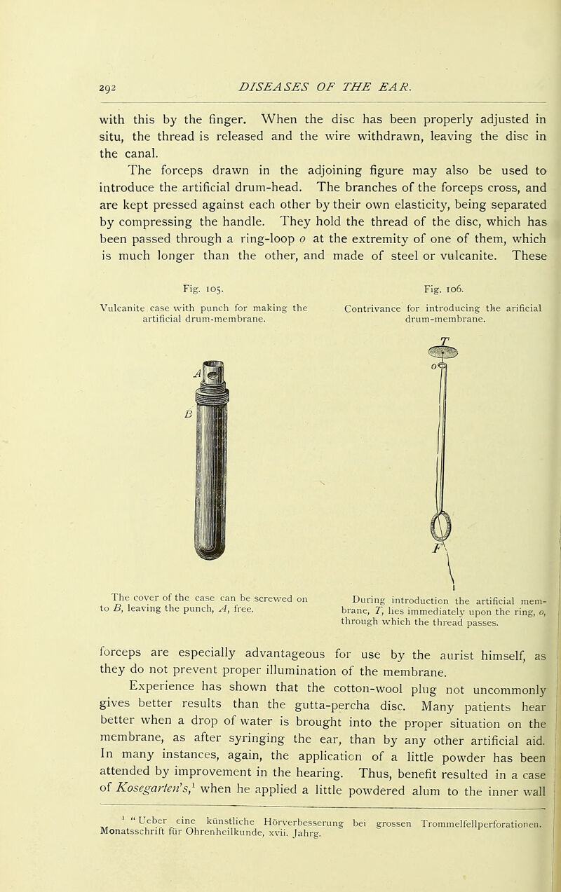 with this by the finger. When the disc has been properly adjusted in situ, the thread is released and the wire withdrawn, leaving the disc in the canal. The forceps drawn in the adjoining figure may also be used to introduce the artificial drum-head. The branches of the forceps cross, and are kept pressed against each other by their own elasticity, being separated by compressing the handle. They hold the thread of the disc, which has been passed through a ring-loop 0 at the extremity of one of them, which is much longer than the other, and made of steel or vulcanite. These Fig. 105. Vulcanite case with punch for making the artificial drum-membrane. Fig. 106. Contrivance for introducing the arificial drum-membrane. The cover of the case can be screwed on to B, leaving the punch, A, free. During introduction the artificial mem- brane, T, lies immediately upon the ring, o, through which the thread passes. 1  Ueber eine künstliche Hörverbessen Monatsschrift für Ohrenheilkunde, xvii. Jahrg. grossen Trommelfellperforationen. forceps are especially advantageous for use by the aurist himself, as they do not prevent proper illumination of the membrane. Experience has shown that the cotton-wool plug not uncommonly gives better results than the gutta-percha disc. Many patients hear better when a drop of water is brought into the proper situation on the membrane, as after syringing the ear, than by any other artificial aid. In many instances, again, the application of a little powder has been attended by improvement in the hearing. Thus, benefit resulted in a case of Kosegarten's,1 when he applied a little powdered alum to the inner wall