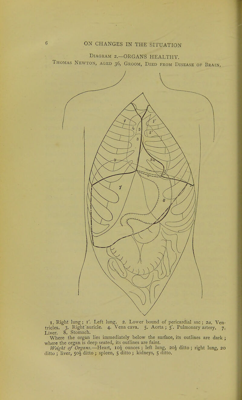 Diagram 2,—ORGANS HEALTHY. Thomas Newton, aged 36, Groom, Died from Disease of Brain. I, Right lung; i'. Left lung. 2. Lower bound of pericardial sac; 2a. Ven- tricles, 3. Right 'auricle. 4. Vena cava. 5. Aorta ; 5'. Pulmonary artery. 7. Liver. 8. Stomach. Where the organ lies immediately belovvf the surface, its outlines are dark ; where the organ is deep seated, its outlines are faint. Weight of Organs.—Heart, 10^ ounces ; left lung, 2o\ ditto ; right lung, 20