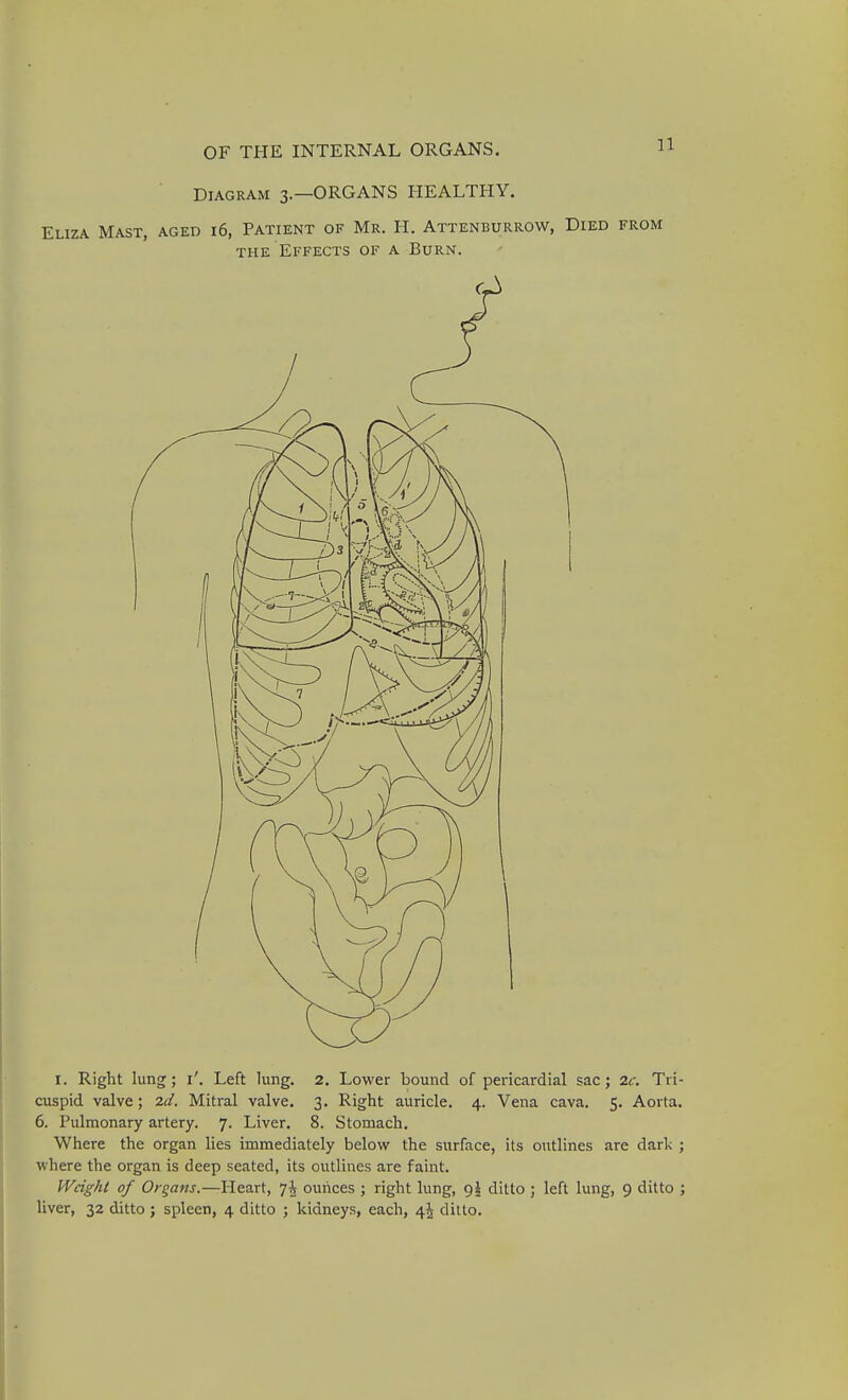 Diagram 3.—ORGANS HEALTHY. Eliza Mast, aged 16, Patient of Mr. H. Attenburrow, Died from THE Effects of a Burn. I. Right lung; i'. Left lung. 2, Lower bound of pericardial sac; 2c. Tri- cuspid valve; 2d. Mitral valve. 3. Right auricle. 4. Vena cava. 5. Aorta. 6. Pulmonary artery. 7. Liver. 8. Stomach. Where the organ lies immediately below the surface, its outlines are dark ; where the organ is deep seated, its outlines are faint. IVcighl of Organs.—Heart, 7| ounces ; right lung, 9I ditto ; left lung, 9 ditto ; liver, 32 ditto; spleen, 4 ditto ; kidneys, each, 44 ditto.