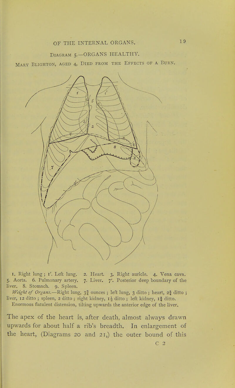 Diagram 5.—ORGANS HEALTHY. Mary Blighton, aged 4, Died from the Effects of a Burn. I. Right lung; i'. Left lung. 2. Heart. 3, Right auricle. 4. Vena cava. 5. Aorta. 6. Pulmonary artery. 7. Liver, 7'. Posterior deep boundary of the liver. 8. Stomach. 9. Spleen. IVdght of Or^'awj.—Right lung, 3I ounces ; left lung, 3 ditto ; heart, 2| ditto ; liver, 12 ditto ; spleen, 2 ditto ; right kidney, i\ ditto ; left kidney, if ditto. Enormous flatulent distension, tilting upwards the anterior edge of the liver. The apex of the heart is, after death, almost always drawn upwards for about half a rib's breadth. In enlargement of the heart, (Diagrams 20 and 21,) the outer bound of this