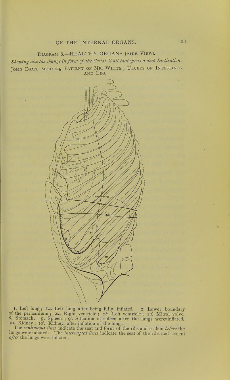 Diagram 6.—HEALTHY ORGANS (Side View). Shmving also the change in form of the Costal Wall that effects a deep Inspiration. John Egan, aged 23, Patient of Mr. White ; Ulcers of Intestines AND Leg. I. Left lung; \a. Left lung after being fully inflated. 2. Lower boundary of the pericardium ; 2a. Right ventricle ; 2(J. Left ventricle; id. Mitral valve. 8. Stomach. 9. Spleen ; 9'. Situation of spleen after the lungs were^inflated. 10. Kidney ; 10'. Kidney, after inflation of the lungs. The continuous lines indicate the seat and form of the ribs and scaleni before the lungs were inflated. The interrupted lines indicate the seat of the ribs and scaleni after the lungs were inflated.