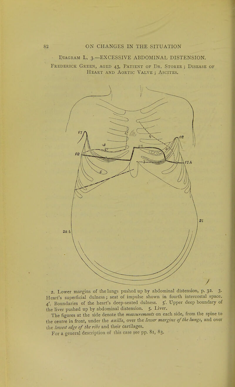 Diagram L. 3.—EXCESSIVE ABDOMINAL DISTENSION. Frederick Green, aged 43, Patient of Dr. Storer ; Disease of Heart and Aortic Valve j Ascites. 21 2. Lower margins of the lungs pushed up by abdominal distension, p. 32. 3. Heart's superficial dulness ; seat of impulse shown in fourth intercostal space. 4'. Boundaries of the heart's deep-seated dulness. 5'. Upper deep boundaiy of the liver pushed up by abdominal distension. 5. Liver. The figures at the side denote the measurements on each side, from the spine to the centre in front, under the axilla, over the Icnoer margins 0/the lungs, and over the loivest edge of the ribs and their cartilages. For a general description of this case see pp. 81, 83.