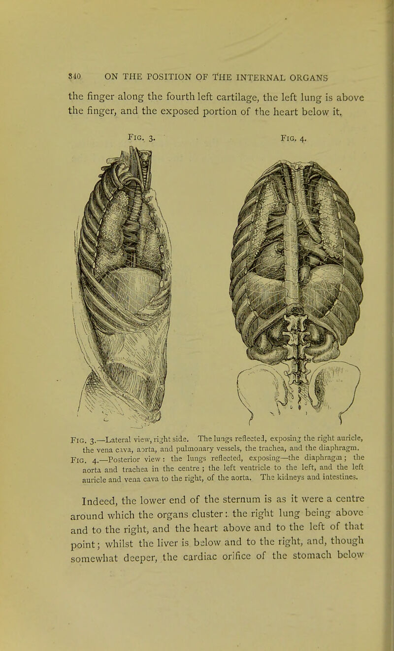 the finger along the fourth left cartilage, the left lung is above the finger, and the exposed portion of the heart below it, Fig. 3. Fig. 4. Fig. 3.—Lateral view, vight side. The lungs reflected, exposing tlie right auricle, the vena cava, aorta, and pulmonary vessels, the trachea, and the diaphragm. Fig, 4.—Posterior view: the lungs reflected, exposing—the diaphragm; the aorta and trachea in the centre ; the left ventricle to the left, and the left auricle and vena cava to the right, of the aorta. Ths kidneys and intestines. Indeed, the lower end of the sternum is as it were a centre around which the organs cluster:, the right lung being above and to the right, and the heart above and to the left of that point; whilst the liver is bdow and to the right, and, though somewhat deeper, the cardiac orifice of the stomach below