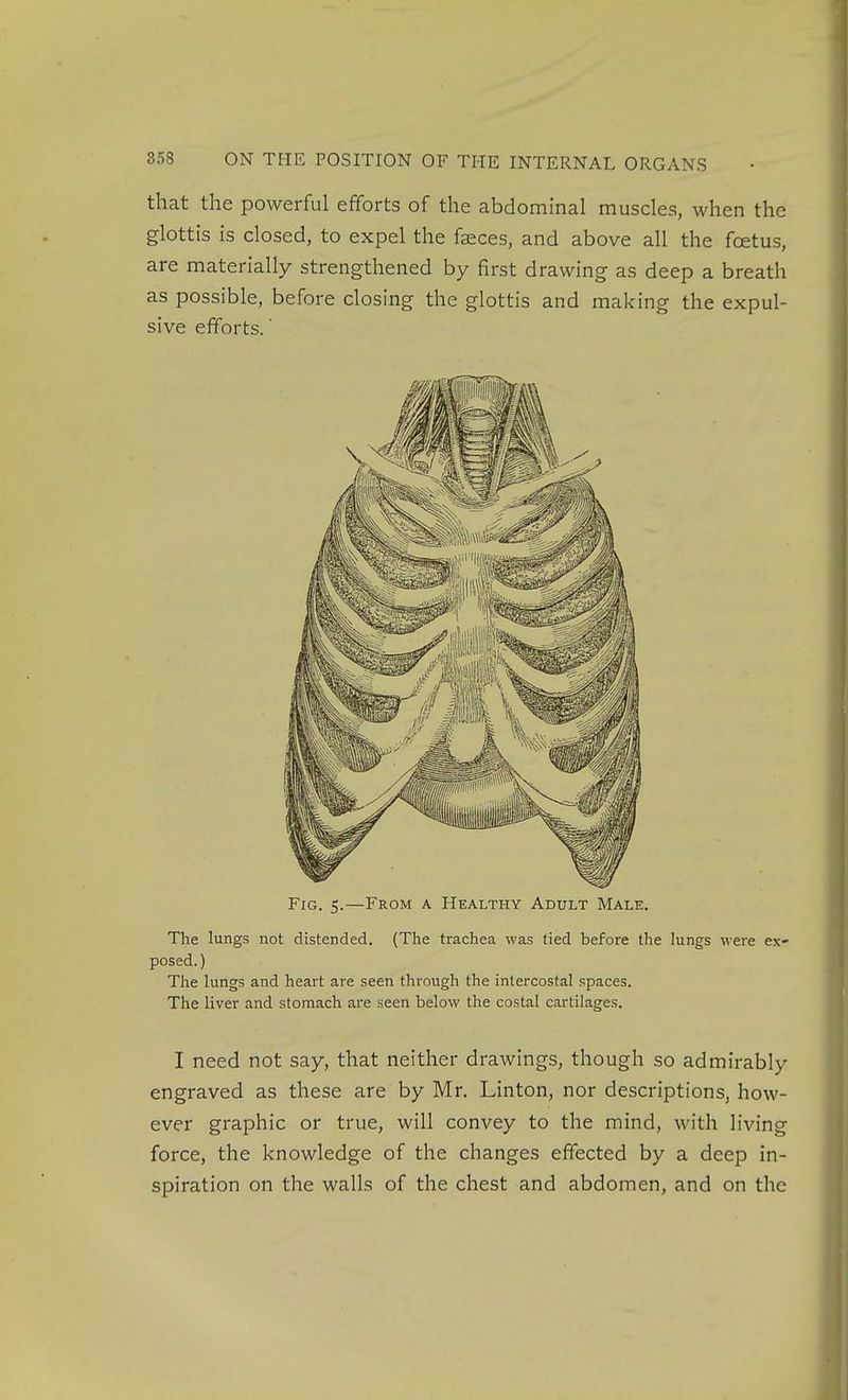 that the powerful efforts of the abdominal muscles, when the glottis is closed, to expel the faeces, and above all the foetus, are materially strengthened by first drawing as deep a breath as possible, before closing the glottis and making the expul- sive efforts.' Fig. s.—From a Healthy Adult Male. The lungs not distended. (The trachea was tied before the lungs were ex- posed. ) The lungs and heart are seen through the intercostal spaces. The liver and stomach are seen below the costal cartilages. I need not say, that neither drawings, though so admirably engraved as these are by Mr. Linton, nor descriptions, how- ever graphic or true, will convey to the mind, with living force, the knowledge of the changes effected by a deep in- spiration on the walls of the chest and abdomen, and on the