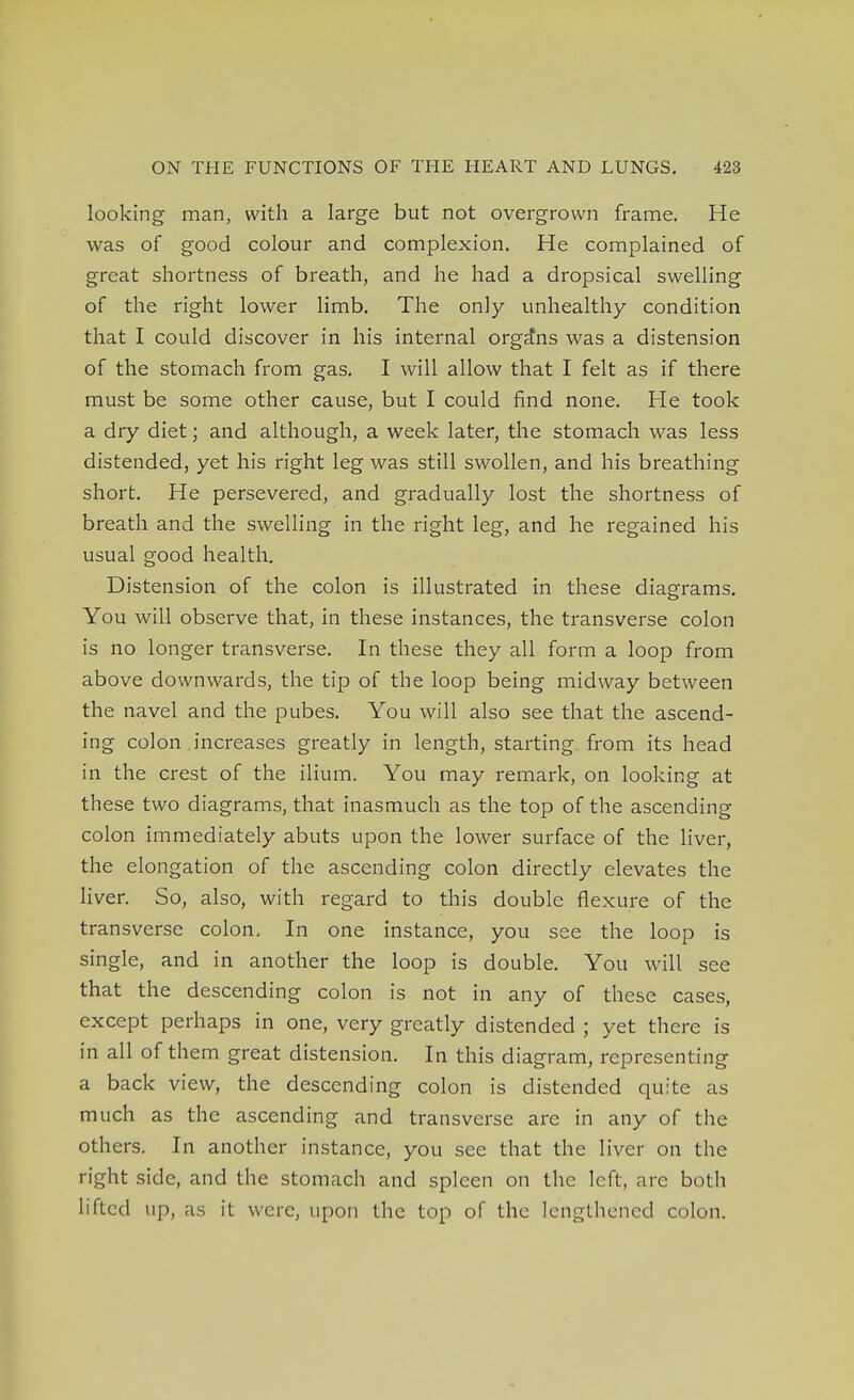 looking man, with a large but not overgrown frame. He was of good colour and complexion. He complained of great shortness of breath, and he had a dropsical swelling of the right lower limb. The only unhealthy condition that I could discover in his internal orga*ns was a distension of the stomach from gas. I will allow that I felt as if there must be some other cause, but I could find none. He took a dry diet; and although, a week later, the stomach was less distended, yet his right leg was still swollen, and his breathing short. He persevered, and gradually lost the shortness of breath and the swelling in the right leg, and he regained his usual good health. Distension of the colon is illustrated in these diagrams. You will observe that, in these instances, the transverse colon is no longer transverse. In these they all form a loop from above downwards, the tip of the loop being midway between the navel and the pubes. You will also see that the ascend- ing colon increases greatly in length, starting from its head in the crest of the ilium. You may remark, on looking at these two diagrams, that inasmuch as the top of the ascending colon immediately abuts upon the lower surface of the liver, the elongation of the ascending colon directly elevates the liver. So, also, with regard to this double flexure of the transverse colon. In one instance, you see the loop is single, and in another the loop is double. You will see that the descending colon is not in any of these cases, except perhaps in one, very greatly distended ; yet there is in all of them great distension. In this diagram, representing a back view, the descending colon is distended quite as much as the ascending and transverse are in any of the others. In another instance, you see that the liver on the right side, and the stomach and spleen on the left, arc both lifted up, as it were, upon the top of the lengthened colon.