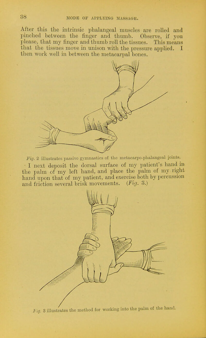 After this the intiinsic phalangeal muscles are rolled and pmched between the finger and thumb. Observe, if you please, that my finger and thumb roll the tissues. This means that the tissues move in unison with the pressure applied. I then work well in between the metacarpal bones. Fig. 2 illustrates passive gymnastics of the metacarpo-plialangeal joiats. ■ I next deposit the dorsal sm-face of my patient's hand in the palm of my left hand, and place the palm of my right hand upon that of my patient, and exercise both by percussion and friction several brisk movements. {Fig. 3.)