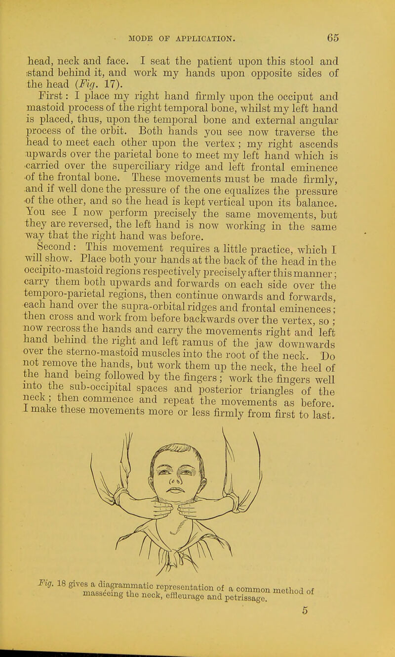 head, neck and face. I seat the patient upon this stool and istand behind it, and work my hands upon opposite sides of the head {Fig. 17). First: I place my right hand firmly upon the occiput and mastoid process of the right temporal bone, whilst my left hand is placed, thus, upon the temporal bone and external angular process of the orbit. Both hands you see now traverse the head to meet each other upon the vertex; my right ascends upwards over the parietal bone to meet my left hand which is carried over the supercihary ridge and left frontal emmence ■of the frontal bone. These movements must be made firmly, and if well done the pressure of the one equahzes the pressure ■of the other, and so the head is kept vertical upon its balance. You see I now perform precisely the same movements, but they are reversed, the left hand is now working in the same ivay that the right hand was before. Second : This movement requires a little practice, which I will show. Place both your hands at the back of the head in the occipito-mastoid regions respectively precisely after this manner; carry them both upwards and forwards on each side over the temporo-parietal regions, then continue onwards and forwards, each hand over the supra-orbital ridges and frontal emmences' then cross and work from before backwards over the vertex, so ; now recross the hands and carry the movements right and left hand behmd the right and left ramus of the jaw downwards over the sterno-mastoid muscles into the root of the neck. Do not remove the hands, but work them up the neck, the heel of the hand bemg followed by the fingers ; work the fingers well mto the sub-occipital spaces and posterior triangles of the neck; then commence and repeat the movements as before. 1 make these movements more or less firmly from first to last Fig. 18 gives a diagrammatic representation of a common method of masseemg the neck, efflem-age and petrissage