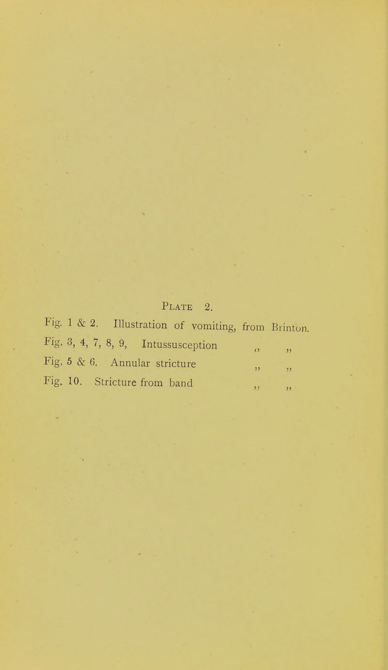 Fig. 1 & 2. Illustration of vomiting, from Brinton. Fig. 3, 4, 7, 8, 9, Intussusception Fig. 5 & 6. Annular stricture