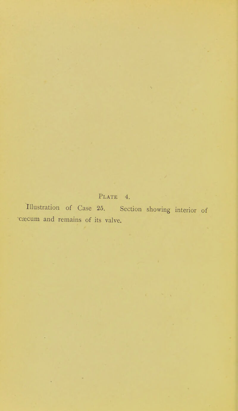 Illustration of Case 25. Section showing interior of cajcum and remains of its valve.