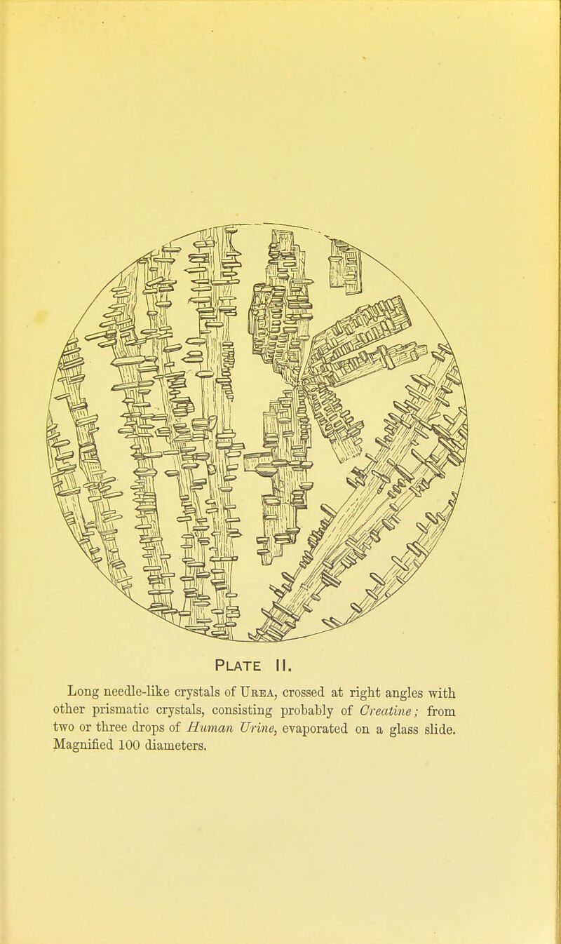 Long needle-like crystals of Urea, crossed at right angles with other prismatic crystals, consisting probably of Creatine; from two or three drops of Human Urine, evaporated on a glass slide. Magnified 100 diameters.