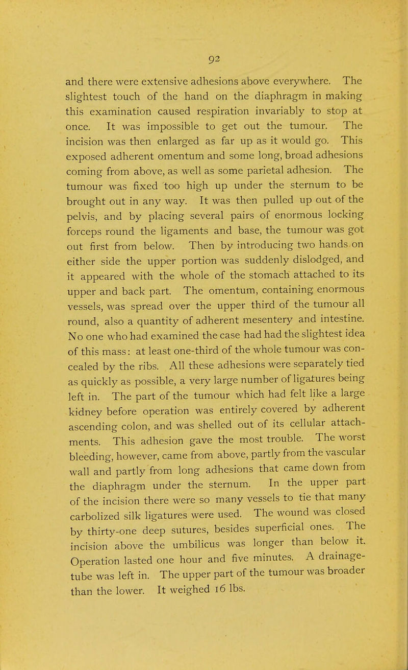 and there were extensive adhesions above everywhere. The slightest touch of the hand on the diaphragm in making this examination caused respiration invariably to stop at once. It was impossible to get out the tumour. The incision was then enlarged as far up as it would go. This exposed adherent omentum and some long, broad adhesions coming from above, as well as some parietal adhesion. The tumour was fixed too high up under the sternum to be brought out in any way. It was then pulled up out of the pelvis, and by placing several pairs of enormous locking forceps round the ligaments and base, the tumour was got out first from below. Then by introducing two hands on either side the upper portion was suddenly dislodged, and it appeared with the whole of the stomach attached to its upper and back part. The omentum, containing enormous vessels, was spread over the upper third of the tumour all round, also a quantity of adherent mesentery and intestine. No one who had examined the case had had the slightest idea of this mass: at least one-third of the whole tumour was con- cealed by the ribs. All these adhesions were separately tied as quickly as possible, a very large number of ligatures being left in. The part of the tumour which had felt like a large kidney before operation was entirely covered by adherent ascending colon, and was shelled out of its cellular attach- ments. This adhesion gave the most trouble. The worst bleeding, however, came from above, partly from the vascular wall and partly from long adhesions that came down from the diaphragm under the sternum. In the upper part of the incision there were so many vessels to tie that many carbolized silk ligatures were used. The wound was closed by thirty-one deep sutures, besides superficial ones. The incision above the umbilicus was longer than below it. Operation lasted one hour and five minutes. A drainage- tube was left in. The upper part of the tumour was broader than the lower. It weighed 16 lbs.