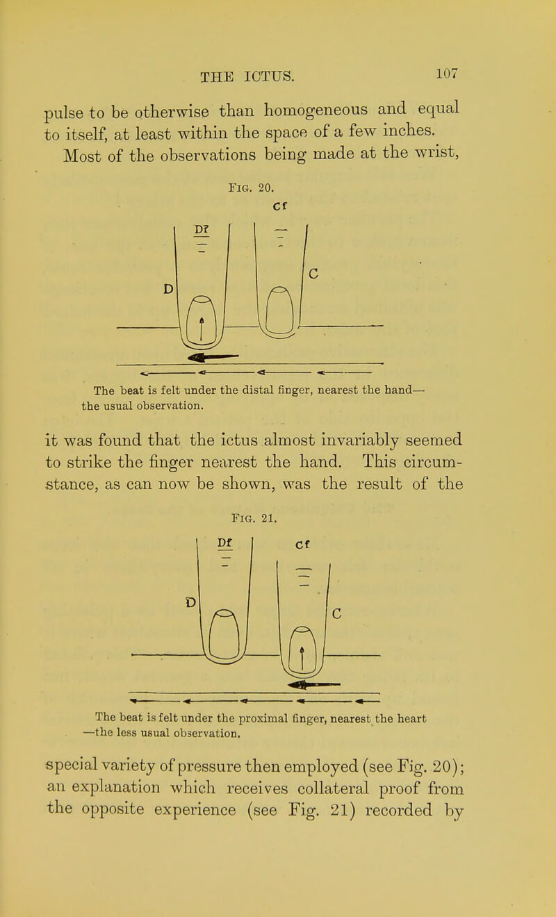 pulse to be otherwise than homogeneous and equal to itself, at least within the space of a few inches. Most of the observations being made at the wrist, Fig. 20. Cf The beat is felt under the distal finger, nearest the hand— the usual observation. it was found that the ictus almost invariably seemed to strike the finger nearest the hand. This circum- stance, as can now be shown, was the result of the Fig. 21. The beat is felt under the proximal finger, nearest the heart —the less usual observation. special variety of pressure then employed (see Fig. 20); an explanation which receives collateral proof from the opposite experience (see Fig. 21) recorded by