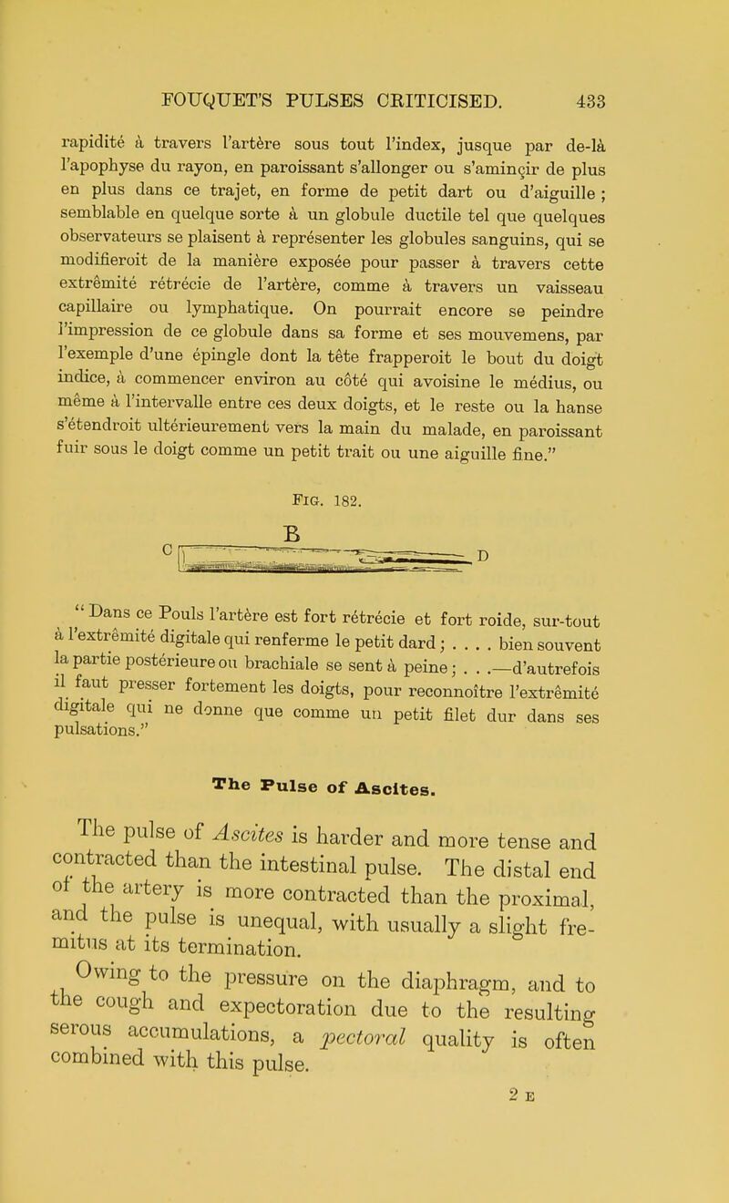 rapidite a travers I'artere sous tout l'index, jusque par de-la I'apophyse du rayon, en paroissant s'allonger ou s'aminQir de plus en plus dans ce trajet, en forme de petit dart ou d'aiguille ; semblable en quelque sorte a un globule ductile tel que quelques observateurs se plaisent a representer les globules sanguins, qui se modifieroit de la maniere exposee pour passer a travers cette extremite retrecie de I'artere, comme a travers un vaisseau capillaire ou lymphatique. On pourrait encore se peindre I'impression de ce globule dans sa forme et ses mouvemens, par I'exemple d'une epingle dont la tete frapperoit le bout du doigt indice, a commencer environ au cote qui avoisine le medius, ou meme a l'intervalle entre ces deux doigts, et le reste ou la hanse s'etendroit ulterieurement vers la main du malade, en paroissant fuir sous le doigt comme un petit trait ou une aiguille fine.  Dans ce Pouls I'artere est fort retrecie et fort roide, sur-tout al'extremitedigitalequirenferme le petit dard; .... biensouvent lapartieposterieureou brachiale se sent a peine; . . .—d'autrefois a faut pressor fortement les doigts, pour reconnoitre l'extremite digxtale qui ne donne que comme un petit filet dur dans ses pulsations. The Pulse of Ascites. The pulse of Ascites is harder and more tense and contracted than the intestinal pulse. The distal end of the artery is more contracted than the proximal, and the pulse is unequal, with usually a slight fre- mitus at its termination. Owing to the pressure on the diaphragm, and to the cough and expectoration due to the resulting serous accumulations, a pectoral quality is often combined with this pulse. 2 E