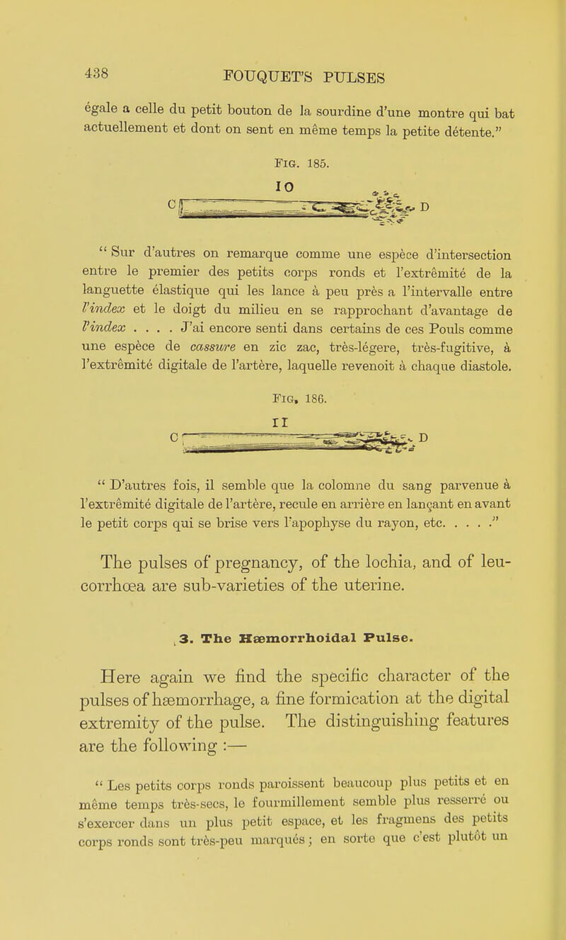 egale a celle du petit bouton de la sourdine d'une montre qui bat actuellement et dont on sent en meme temps la petite detente. Fig. 185.  Sur d'autres on remarque comme une espece d'intersection entre le premier des petits corps ronds et l'extremite de la languette elastique qui les lance a peu pres a 1'intervalle entre Vindex et le doigt du milieu en se rapprochant d'avantage de I'index .... J'ai encore senti dans certains de ces Pouls comme une espece cle cassure en zic zac, tres-legere, tres-fugitive, a l'extremite digitale de l'artere, laquelle revenoit a chaque diastole. Fig, 186.  D'autres fois, il semble que la colomne du sang parvenue a l'extremite digitale de l'artere, recule en arriere en lancant en avant le petit corps qui se brise vers Fapophyse du rayon, etc  The pulses of pregnancy, of the lochia, and of leu- corrhcea are sub-varieties of the uterine. 3. The Heemorrhoidal Pulse. Here again we find the specific character of the pulses of haemorrhage, a fine formication at the digital extremity of the pulse. The distinguishing features are the following :—  Les petits corps ronds paroissent beaucoup plus petits et en meme temps tres-secs, le fourmillement semble plus resserre ou s'exercer dans im plus petit espace, et les fragmens des petits corps ronds sont tres-peu marques; en sortc que c'est plutot un