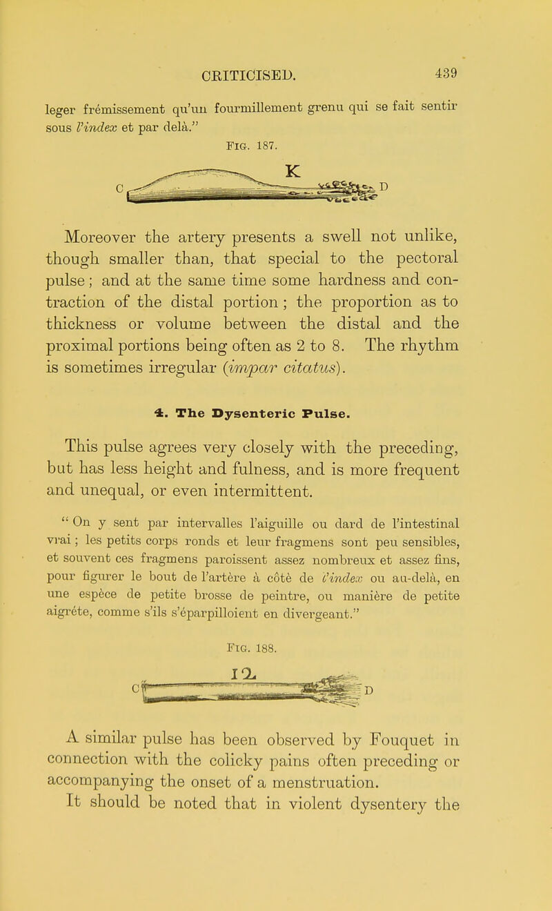 leger fremissement qu'un fourmillement grenu qui se fait sentir sous I'index et par dela. Fig. 187. Moreover the artery presents a swell not unlike, though smaller than, that special to the pectoral pulse ; and at the same time some hardness and con- traction of the distal portion; the proportion as to thickness or volume between the distal and the proximal portions being often as 2 to 8. The rhythm is sometimes irregular (impar citatus). <k. The Dysenteric Pulse. This pulse agrees very closely with the preceding, but has less height and fulness, and is more frequent and unequal, or even intermittent. On y sent par intervalles l'aiguille ou clard de l'intestinal vi-ai; les petits corps ronds et leur fragmens sont peu sensibles, et souvent ces fragmens paroissent assez nombreux et assez fins, pour figurer le bout de l'artere a cote de I'index ou au-dela, en une espece de petite brosse de peintre, ou maniere de petite aigrete, comme s'ils s'eparpilloient en divei^geant. Fig. 188. A similar pulse has been observed by Fouquet in connection with the colicky pains often preceding or accompanying the onset of a menstruation. It should be noted that in violent dysentery the
