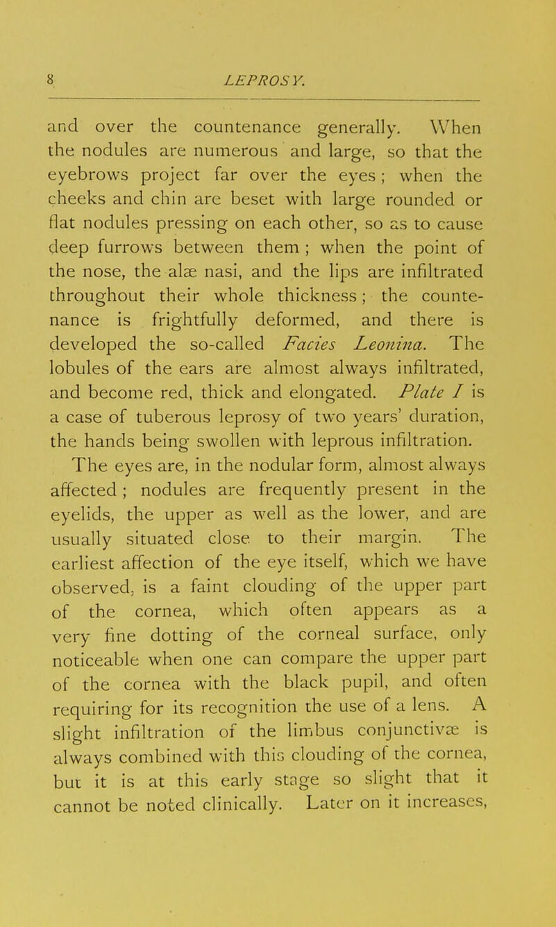 and over the countenance generally. When the nodules are numerous and large, so that the eyebrows project far over the eyes; when the cheeks and chin are beset with large rounded or flat nodules pressing on each other, so as to cause deep furrows between them ; when the point of the nose, the alae nasi, and the lips are infiltrated throughout their whole thickness; the counte- nance is frightfully deformed, and there is developed the so-called Fades Leonina. The lobules of the ears are almost always infiltrated, and become red, thick and elongated. Plate I is a case of tuberous leprosy of two years' duration, the hands being swollen with leprous infiltration. The eyes are, in the nodular form, almost always affected ; nodules are frequently present in the eyelids, the upper as well as the lower, and are usually situated close to their margin. The earliest affection of the eye itself, which we have observed, is a faint clouding of the upper part of the cornea, which often appears as a very fine dotting of the corneal surface, only noticeable when one can compare the upper part of the cornea with the black pupil, and often requiring for its recognition the use of a lens. A slight infiltration of the limbus conjunctivae is always combined with this clouding of the cornea, but it is at this early stage so slight that it cannot be noted clinically. Later on it increases,