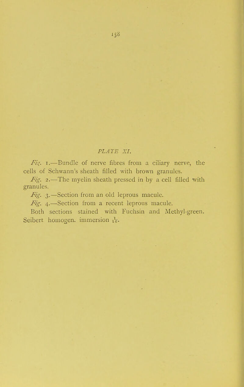158 PLATE XI. Fii^. T.—Bundle of nerve fibres from a ciliary nerve, the cells of Schwann's sheath filled with brown granules. Fig. 2.—The myelin sheath pressed in by a cell filled -with granules. Fig. 3.—Section from an old leprous macule. Fig. 4.—Section from a recent leprous macule. Both sections stained with Fuchsin and Methyl-green.