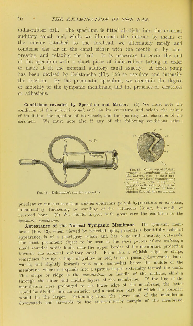india-rubber ball. The speculum is fitted air-tight into the external auditory canal, and, while we illuminate the interior by means of the mirror attached to the forehead, we alternately rarefy and condense the air in the canal either with the mouth, or by com- pressing and relaxing the ball. It is necessary to cover the end of the speculum with a short piece of india-rubber tubing, in order to make it fit the external auditory canal exactly. A force jDump has been devised by Delstanche (Fig. 12) to regulate and intensify the traction. By the pneumatic speculum, we ascertain the degree of mobility of the tympanic membrane, and the presence of cicatrices or adhesions. Conditions revealed by Speculum and Mirror, (l) We must note the condition of the external canal, such as its curvatui'e and width, the colour of its lining, the injection of its vessels, and the quantity and character of the cerumen. We must note also if any of the following conditions exist : Fig. 12.—Delstanche's suction apparatus. Fro. 13.—Outer .aspect of right tympanic membrane — double the natural size ; «, short pro- cess ; h, middle of manubrium ; c, limbo; c', coue of light; e, membr.ana flaccida ; /, posterior fold; g, long process of incus shining through the membrane. purulent or mucous secretion, sodden epidei^mis, polypi, hyperostosis or exostosis, inflammatory thickening or swelling of the cutaneous lining, furunculi, or necrosed bone. (2) We should inspect with great care the condition of the tympanic memh'ane. Appearance of the Normal Tympanic Membrane. The tympanic mem- brane (Fig. 13), when viewed by reflected light, presents a beautifully polished appearance, is of a pearl-grey colour, and has a general concavity outwards. The most prominent object to be seen is the short process of the malleus, a small rounded white knob, near the upper border of the membrane, projecting towards the external auditory canal. From this a whitish ridge or stripe, sometimes having a tinge of yellow or red, is seen passing downwards, back- wards, and slightly inwards to a point somewhat below the middle of the membrane, where it expands into a spatula-shaped extremity termed the tmbo. This stripe or ridge is the manubrium, or handle of the malleus, shining through the outer and middle layers of the membrane. If the line of tlie manubrium were prolonged to the lower edge of the membrane, the latter would be divided into an anterior aud a posterior part, of which the posterior would be the larger. Extending from the lower end of the manubrium downwards and forwards to the antero-inferior margin of the membrane,