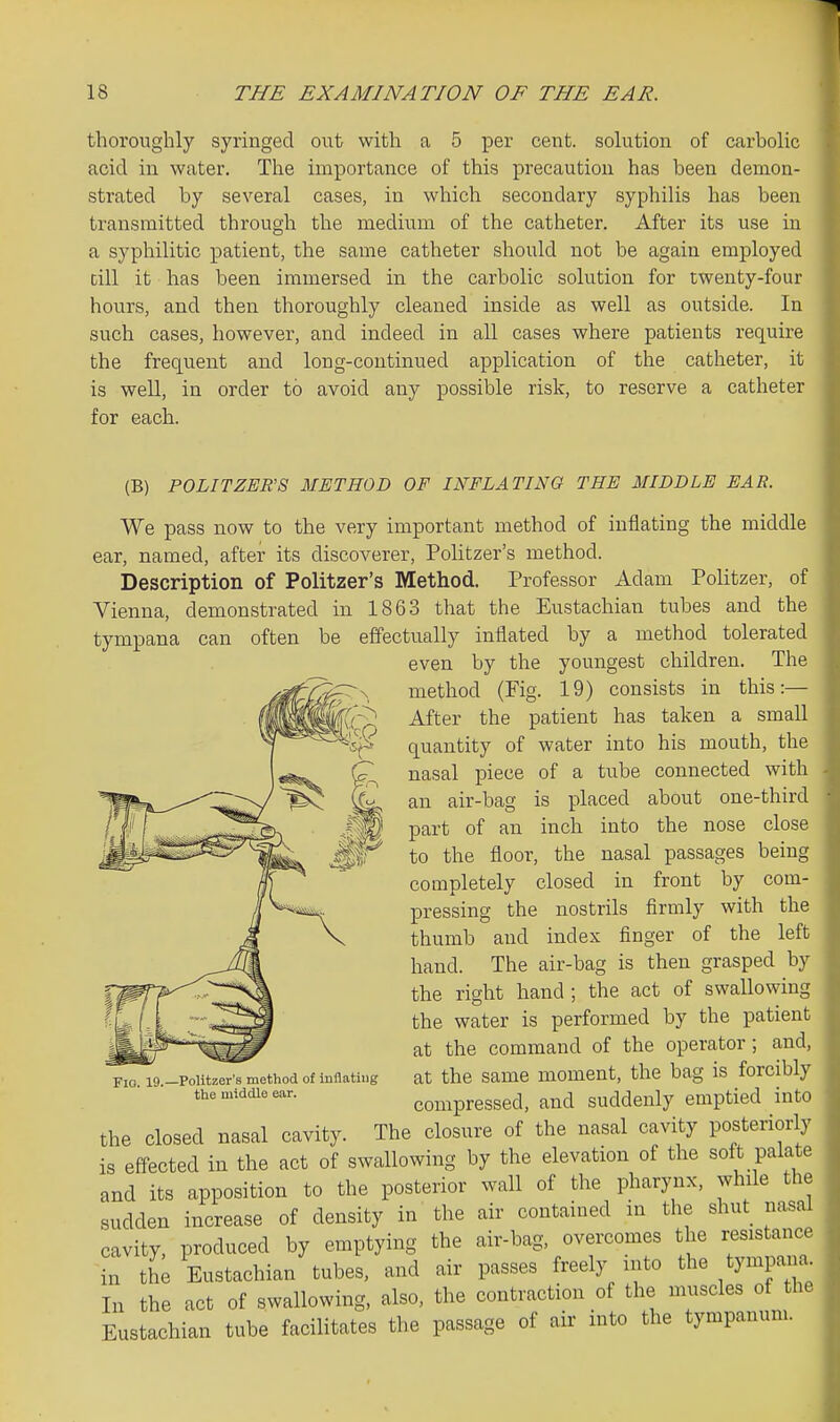 thoroughly syringed out with a 5 per cent, solution of carbolic acid in water. The importance of this precaution has been demon- strated by several cases, in which secondary syphilis has been transmitted through the medium of the catheter. After its use in a syphilitic patient, the same catheter should not be again employed till it has been immersed in the carbolic solution for twenty-four hours, and then thoroughly cleaned inside as well as outside. In such cases, however, and indeed in all cases where patients require the frequent and long-continued application of the catheter, it is well, in order to avoid any possible risk, to reserve a catheter for each. (B) POLITZER'S METHOD OF INFLATING THE MIDDLE EAR. We pass now to the very important method of inflating the middle ear, named, after its discoverer, Politzer's method. Description of Politzer's Method. Professor Adam Politzer, of Vienna, demonstrated in 1863 that the Eustachian tubes and the tympana can often be effectually inflated by a method tolerated even by the youngest children. The method (Fig. 19) consists in this:— After the patient has taken a small quantity of water into his mouth, the nasal piece of a tube connected with an air-bag is placed about one-third part of an inch into the nose close to the floor, the nasal passages being completely closed in front by com- pressing the nostrils firmly with the thumb and index finger of the left hand. The air-bag is then grasped by the right hand ; the act of swallowing the water is performed by the patient at the command of the operator ; and, at the same moment, the bag is forcibly compressed, and suddenly emptied into the closed nasal cavity. The closure of the nasal cavity posteriorly is effected in the act of swallowing by the elevation of the soft palate and its apposition to the posterior wall of the pharynx, while the sudden increase of density in the air contained in the shut nasal cavity, produced by emptying the air-bag, overcomes the resistance in the Eustachian tubes, and air passes freely into the tympana In the act of swallowing, also, the contraction of the muscles of the Eustachian tube facilitates the passage of air into the tympanum. Fi(3_ 19. Politzer's method of inflating the middle ear.