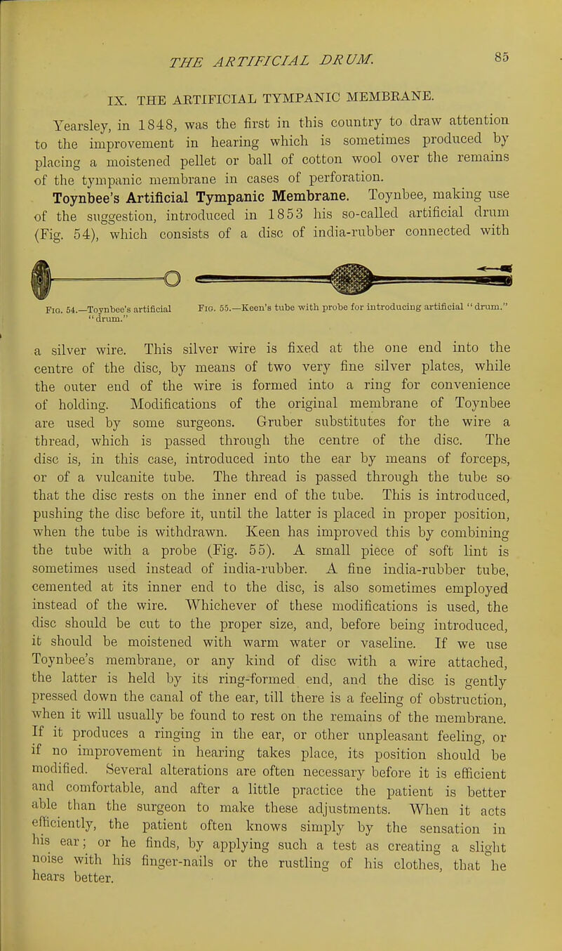 THE ARTIFICIAL DRUM. IX. THE AETIFICIAL TYMPANIC MEMBEANE. Yearsley, in 1848, was the first in this country to draw attention to the improvement in hearing which is sometimes produced by placing a moistened pellet or ball of cotton wool over the remains of the tympanic membrane in cases of perforation. Toynbee's Artificial Tympanic Membrane. Toynbee, making vise of the suo'estion, introduced in 1853 his so-called artificial drum (Fig. 54), which consists of a disc of india-rubber connected with Fio. 54.—Toynbee's artificial Fig. 55.—Keen's tube with probe for introducing artificial drum. drum. a silver wire. This silver wire is fixed at the one end into the centre of the disc, by means of two very fine silver plates, while the outer end of the wire is formed into a ring for convenience of holding. Modifications of the original membrane of Toynbee are used by some surgeons. Gruber substitutes for the wire a thread, which is passed through the centre of the disc. The disc is, in this case, introduced into the ear by means of forceps, or of a vulcanite tube. The thread is passed through the tube so that the disc rests on the inner end of the tube. This is introduced, pushing the disc before it, until the latter is placed in proper position, when the tube is withdrawn. Keen has improved this by combining the tube with a probe (Fig. 55). A small piece of soft lint is sometimes used instead of india-rubber. A fine india-rubber tube, cemented at its inner end to the disc, is also sometimes employed instead of the wire. Whichever of these modifications is used, the disc should be cut to the proper size, and, before being introduced, it should be moistened with warm water or vaseline. If we use Toynbee's membrane, or any kind of disc with a wire attached, the latter is held by its ring-formed end, and the disc is gently pressed down the canal of the ear, till there is a feeling of obstruction, when it will usually be found to rest on the remains of the membrane. If it produces a ringing in the ear, or other unpleasant feeling, or if no improvement in hearing takes place, its position should be modified. Several alterations are often necessary before it is efficient and comfortable, and after a little practice the patient is better able than the surgeon to make these adjustments. When it acts efficiently, the patient often knows simply by the sensation in his ear; or he finds, by applying such a test as creating a slight noise with his finger-nails or the rustling of his clothes, that ^le hears better.