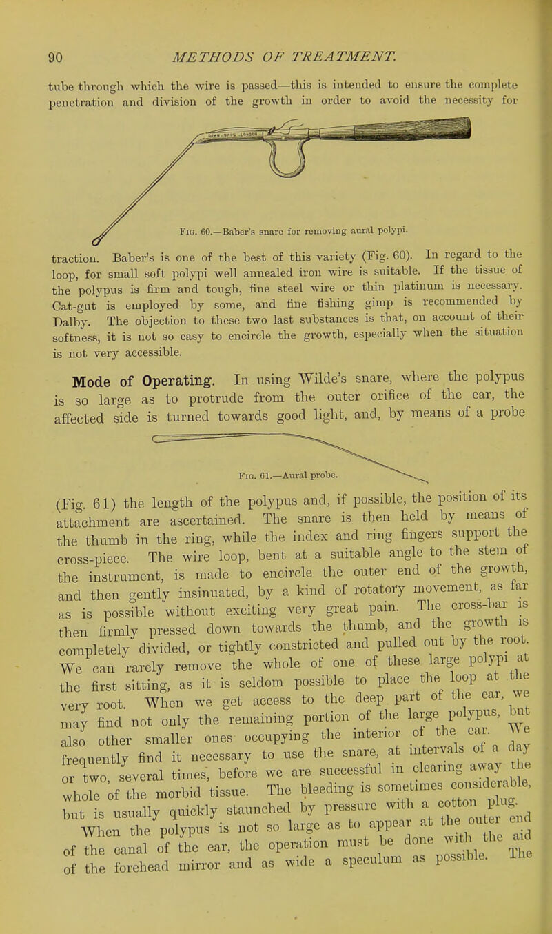 tube through which the wire is passed—this is intended to ensure the complete penetration and division of the growth in order to avoid the necessity for Fig. 60.—Baber's snare for removing aural polypi. traction. Baber's is one of the best of this variety (Fig. 60). In regard to the loop, for small soft polypi well annealed iron wire is suitable. If the tissue of the polypus is firm and tough, fine steel wire or thin platinum is necessary. Cat-gut is employed by some, and fine fishing gimp is recommended by Dalby. The objection to these two last substances is that, on account of their softness, it is not so easy to encircle the growth, especially when the situation is not very accessible. Mode of Operating. In using Wilde's snare, where the polypus is so large as to protrude from the outer orifice of the ear, the affected side is turned towards good light, and, by raeans of a probe Fig. 61.—Aural probe. (Fi« 61) the length of the polypus and, if possible, the position of its attachment are ascertained. The snare is then held by means of the thumb in the ring, while the index and ring fingers support the cross-piece. The wire loop, bent at a suitable angle to the stem ot the instrument, is made to encircle the outer end of the growth, and then gently insinuated, by a kind of rotatory movement, as far as is possible without exciting very great pam. The cross-bar is then firmly pressed down towards the thumb, and the growth is completely divided, or tightly constricted and pulled out by the root We can rarely remove the whole of one of these large polypi at the first sitting, as it is seldom possible to place the loop at the very root. When we get access to the deep part of the ear, we may find not only the remaining portion of the large polypus, but also other smaller ones occupying the interior of the ear. V\e frequently find it necessary to use the snare, at intervals of a d y r two, several times, before we are successful in clearing awaj^ he whole ;f the morbid tissue. The bleeding is --times — but is usually quickly staunched by pressure with a -^^^ ^^^^^^^^^^ When the polypus is not so large as to appear a th ou r of the canal of the ear, the operation must be done with the a.d of the forehead mirror and as wide a speculum as possible. The