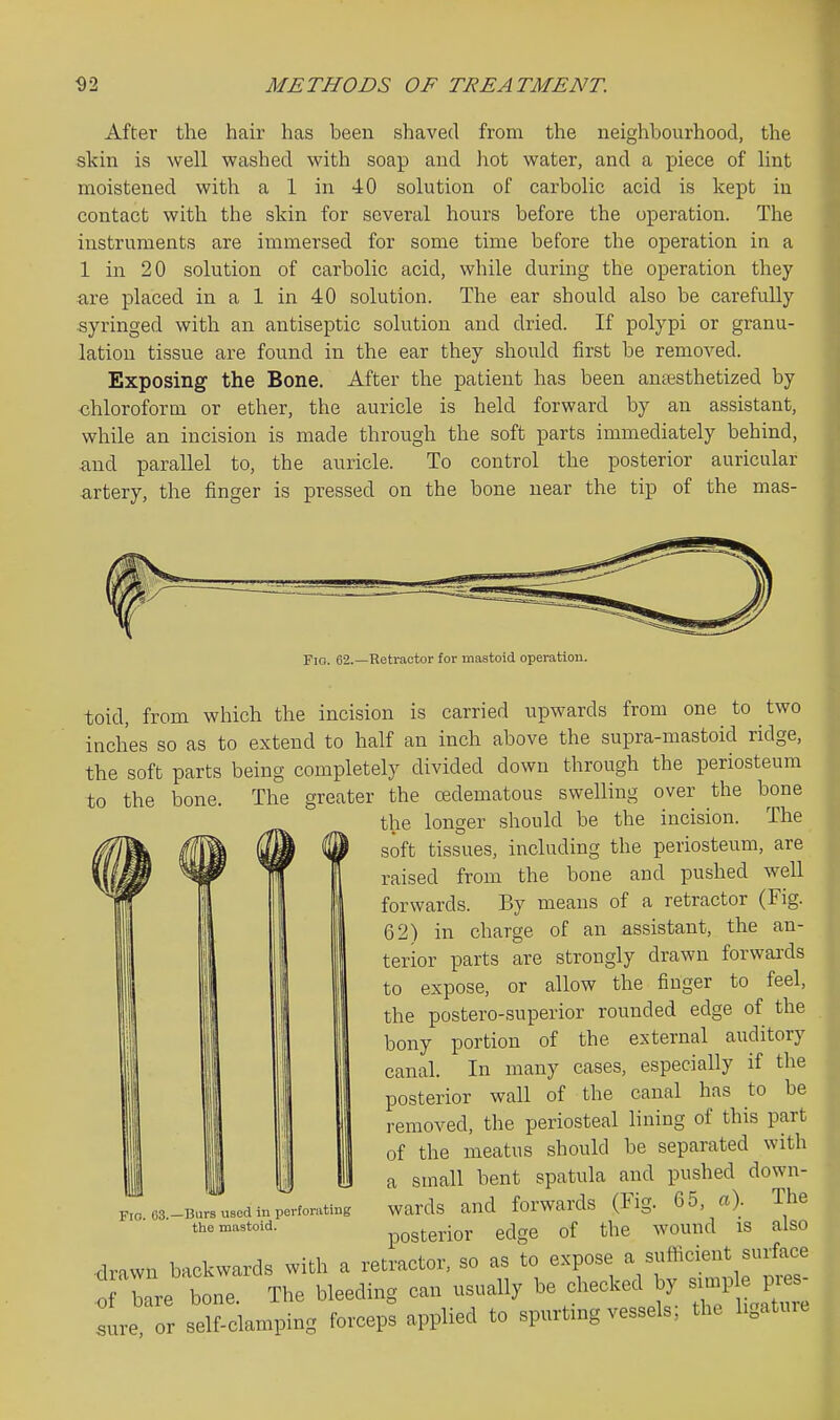 After the hair has been shaved from the neighbourhood, the skin is well washed with soap and hot water, and a piece of lint moistened with a 1 in 40 solution of carbolic acid is kept in contact with the skin for several hours before the operation. The instruments are immersed for some time before the operation in a 1 in 20 solution of carbolic acid, while during the operation they are placed in a 1 in 40 solution. The ear should also be carefully syringed with an antiseptic solution and dried. If polypi or granu- lation tissue are found in the ear they should first be removed. Exposing the Bone. After the patient has been anesthetized by •chloroform or ether, the auricle is held forward by an assistant, while an incision is made through the soft parts immediately behind, and parallel to, the auricle. To control the posterior auricular artery, the finger is pressed on the bone near the tip of the mas- FiG. 62.—Retractor for mastoid operation. toid, from which the incision is carried upwards from one to two inches so as to extend to half an inch above the supra-mastoid ridge, the soft parts being completely divided down through the periosteum to the bone. The greater the oedematous swelling over the bone the longer should be the incision. The soft tissues, including the periosteum, are raised from the bone and pushed well forwards. By means of a retractor (Fig. 62) in charge of an assistant, the an- terior parts are strongly drawn forwai-ds to expose, or allow the finger to feel, the postero-superior rounded edge of the bony portion of the external auditory canal. In many cases, especially if the posterior wall of the canal has to be removed, the periosteal lining of this part of the meatus should be separated with a small bent spatula and pushed down- wards and forwards (Fig. 65, a). The posterior edge of the wound is also •drawn backwards with a retractor, so as to -P°-, ^.^f ^f;^;^:;^- of bare bone. The bleeding can usually be checked by '^fyJZ^ .ure or self-clamping forceps applied to spurtmg vessels, the ligature Fio. 63.—Burs used iu perforating the mastoid.