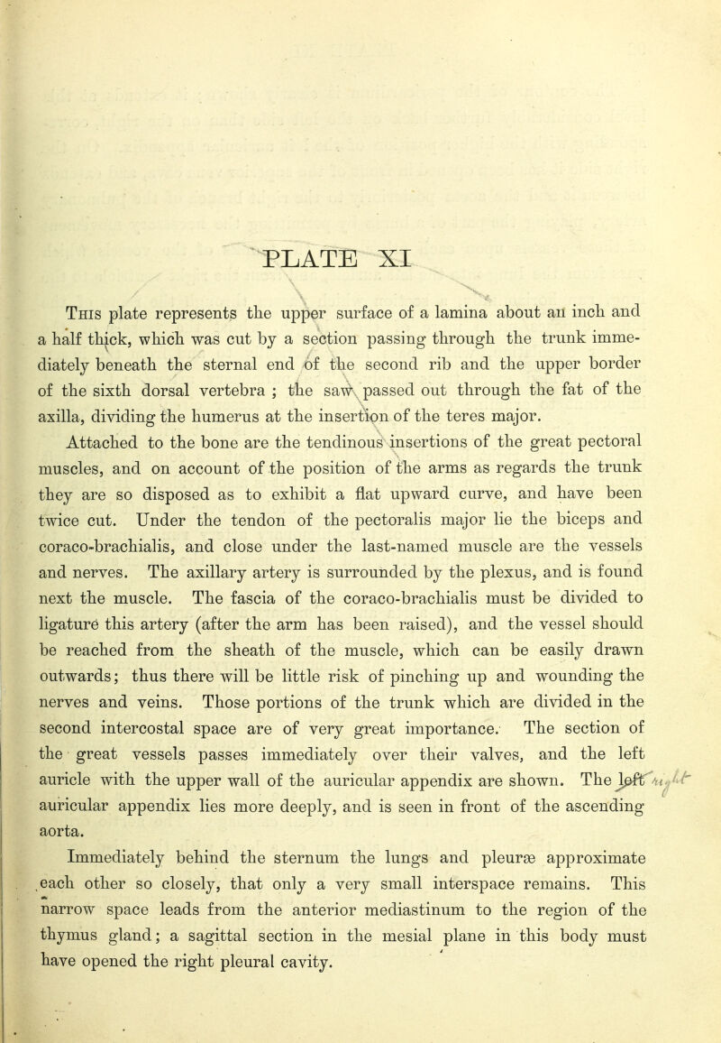 This plate represents the upper surface of a lamina about an incli and a half thick, which was cut by a section passing through the trunk imme- diately beneath the sternal end of the second rib and the upper border of the sixth dorsal vertebra ; the sa#x passed out through the fat of the axilla, dividing the humerus at the insertion of the teres major. Attached to the bone are the tendinous insertions of the great pectoral muscles, and on account of the position of the arms as regards the trunk they are so disposed as to exhibit a flat upward curve, and have been twice cut. Under the tendon of the pectoralis major lie the biceps and coraco-brachialis, and close under the last-named muscle are the vessels and nerves. The axillary artery is surrounded by the plexus, and is found next the muscle. The fascia of the coraco-brachialis must be divided to ligature this artery (after the arm has been raised), and the vessel should be reached from the sheath of the muscle, which can be easily drawn outwards; thus there will be little risk of pinching up and wounding the nerves and veins. Those portions of the trunk which are divided in the second intercostal space are of very great importance. The section of the great vessels passes immediately over their valves, and the left auricle with the upper wall of the auricular appendix are shown. The J^f^ v auricular appendix lies more deeply, and is seen in front of the ascending aorta. Immediately behind the sternum the lungs and pleurse approximate ,each other so closely, that only a very small interspace remains. This narrow space leads from the anterior mediastinum to the region of the thymus gland; a sagittal section in the mesial plane in this body must have opened the right pleural cavity.